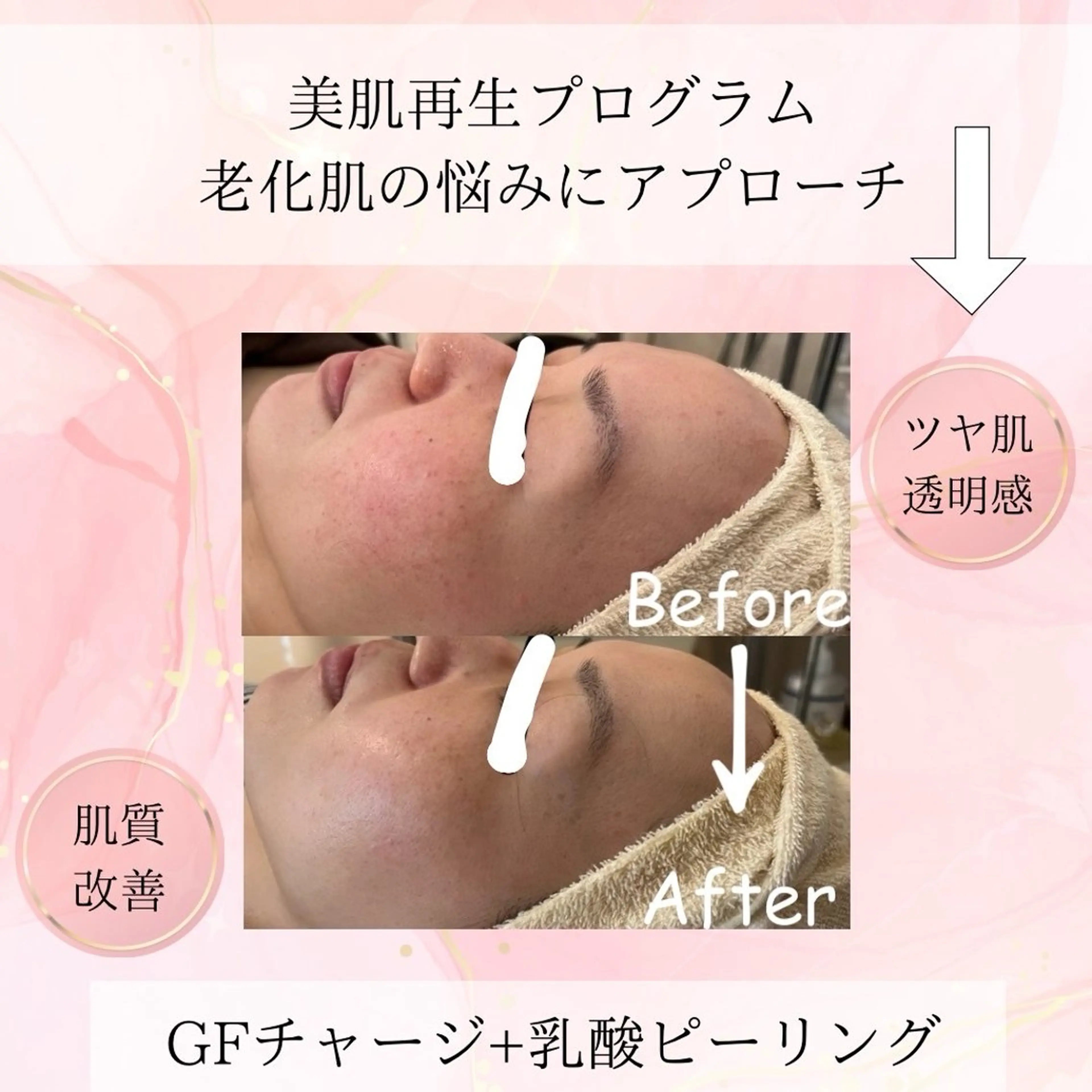 beauty SalonRcoinのマツエク・マツパデザイン