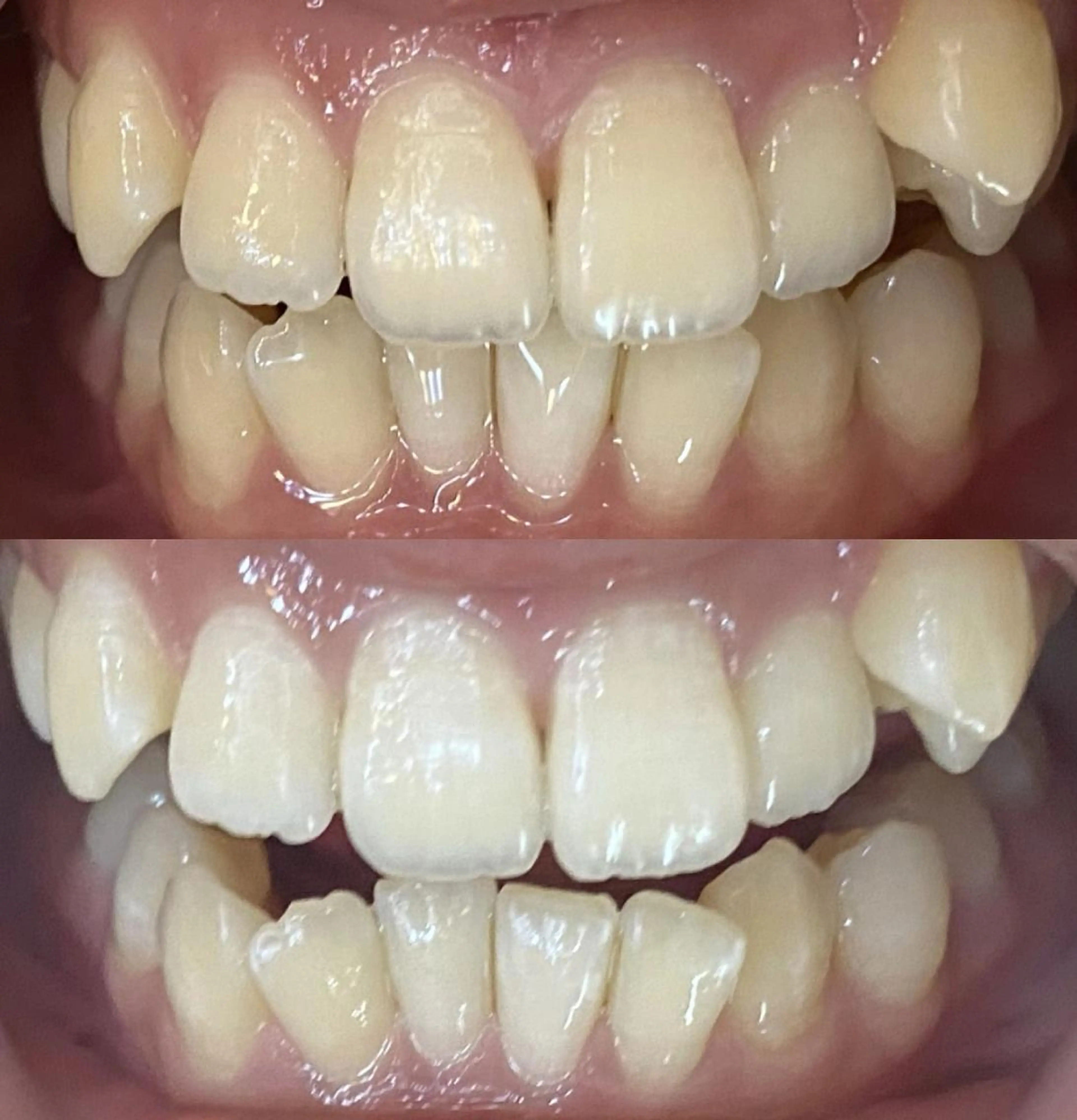 LBSホワイトニング 新宿店💝店長熊倉のエステ・リラクイメージ