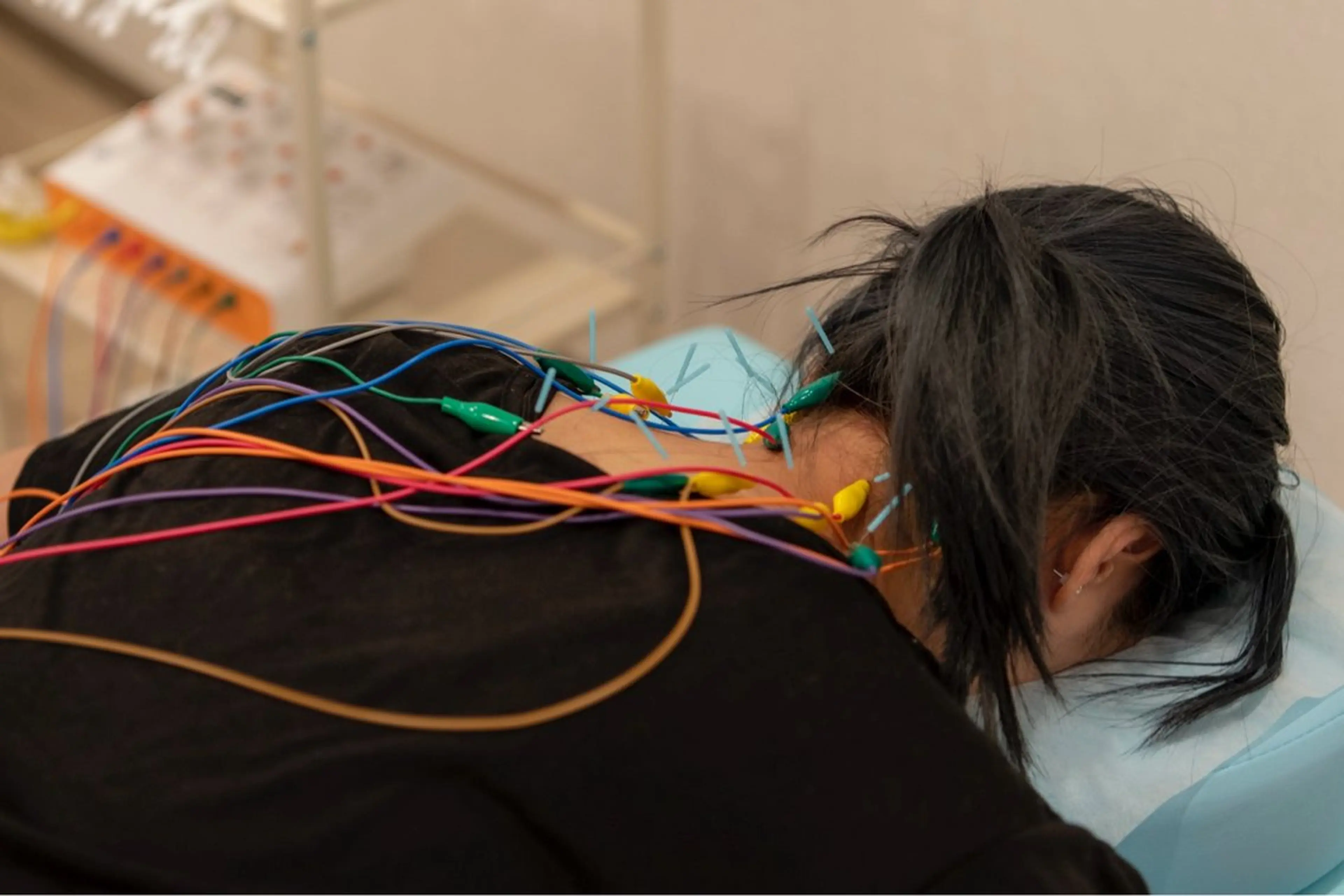 【眼精疲労・頭痛改善】スッキリ爽快✳︎ドライヘッドスパ20分+鍼施術60分＝80分コースの写真