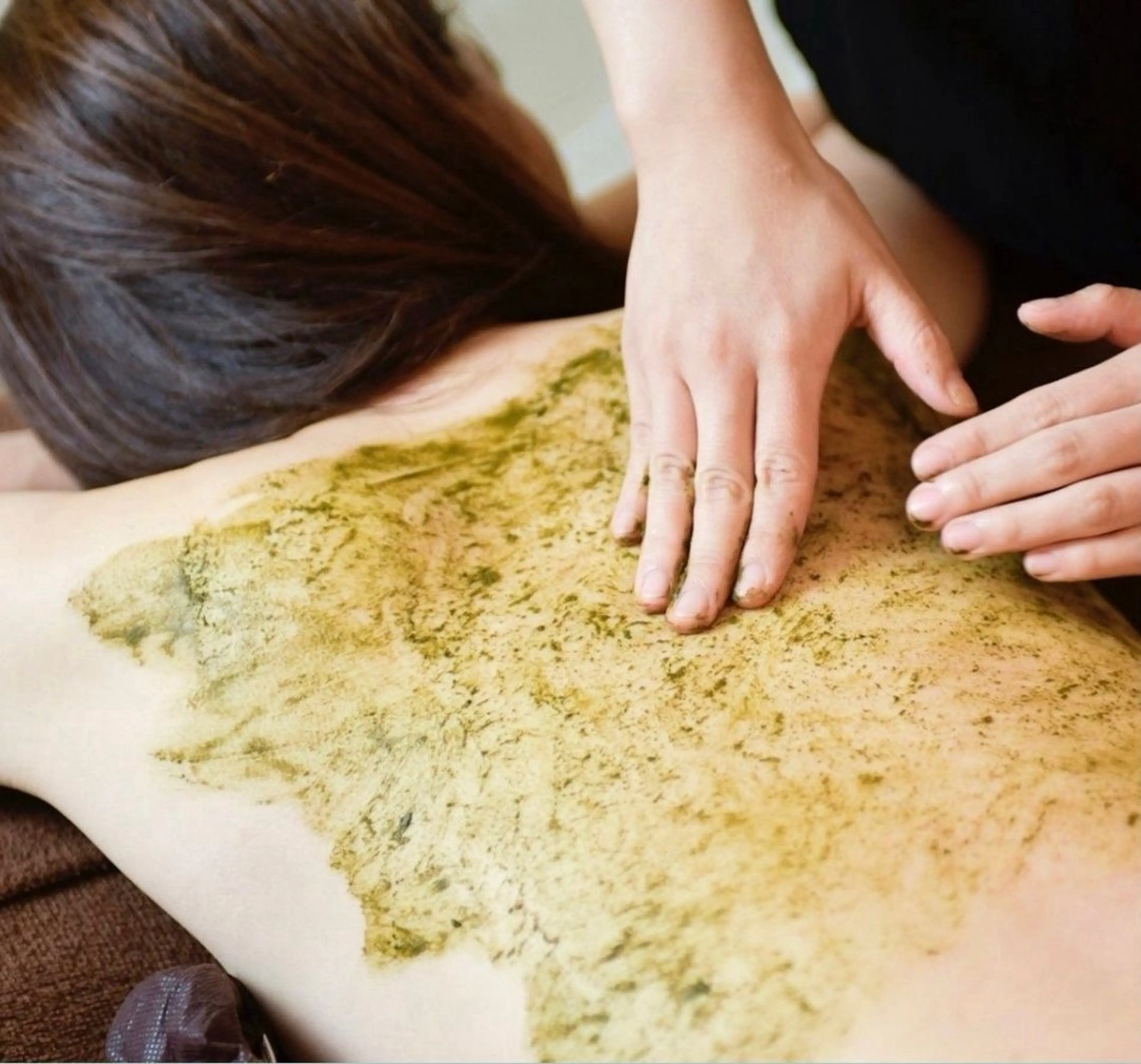 【ミニモ価格】背中全体　剥離ハーブピーリング🌿　アフターケア付き｜毛孔性苔癬、ニキビ跡、色素沈着でお悩みの方にの写真