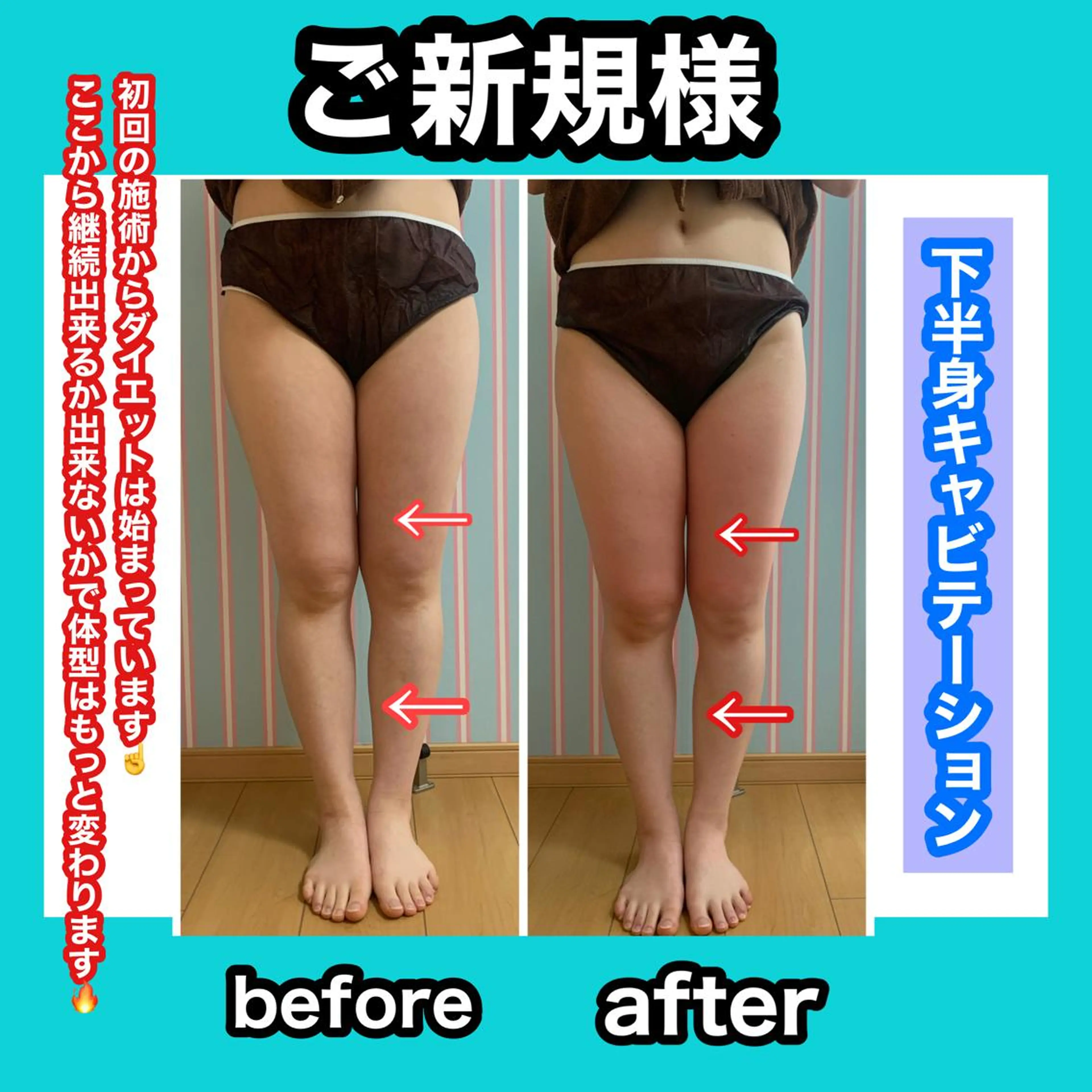 エステ リラク 痩身/脱毛/ネイル HARUKAのエステ・リラクイメージ