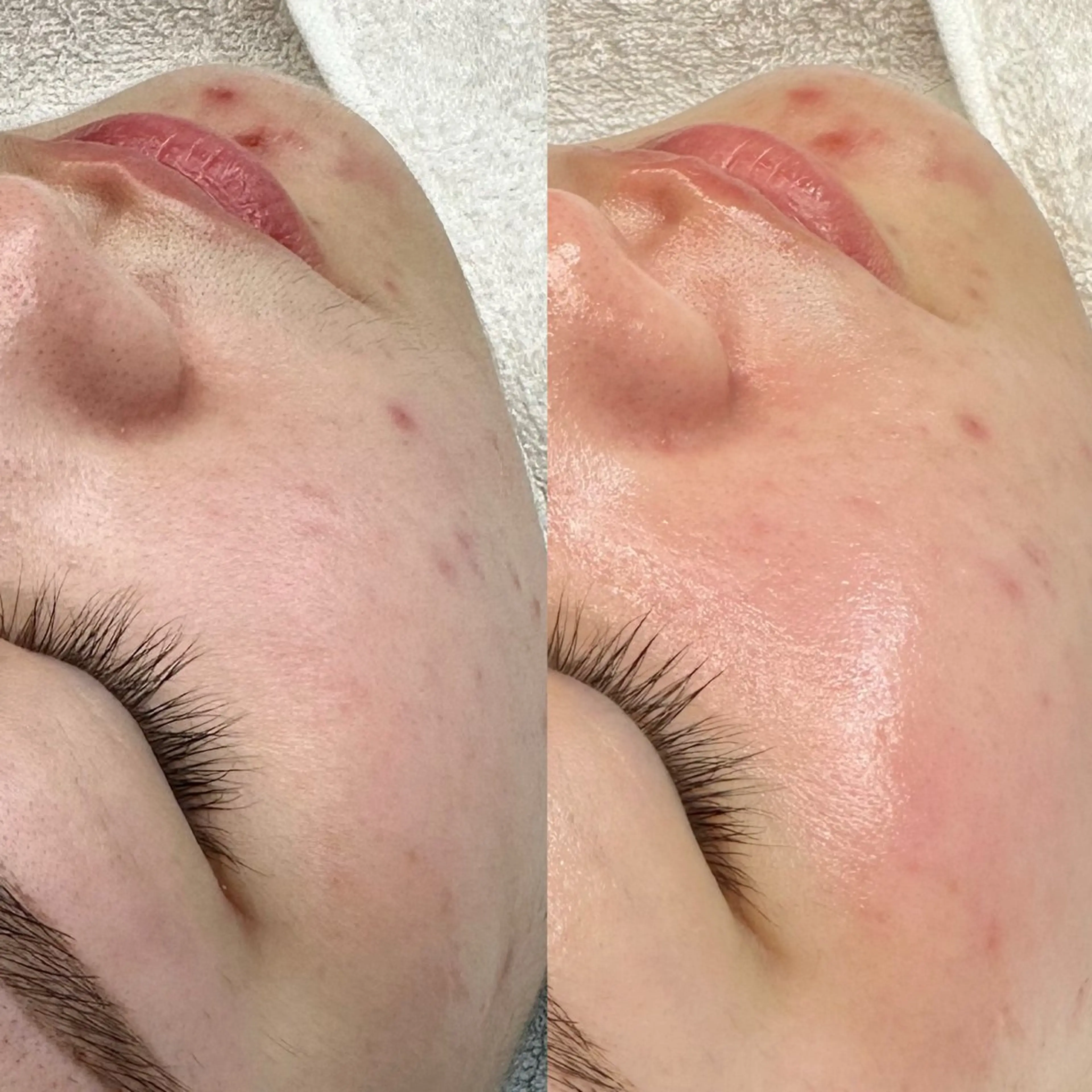 エステ Lei beauty salon所属・松ヤニワックス専門/ 梅田/Leiのエステ・リラクイメージ