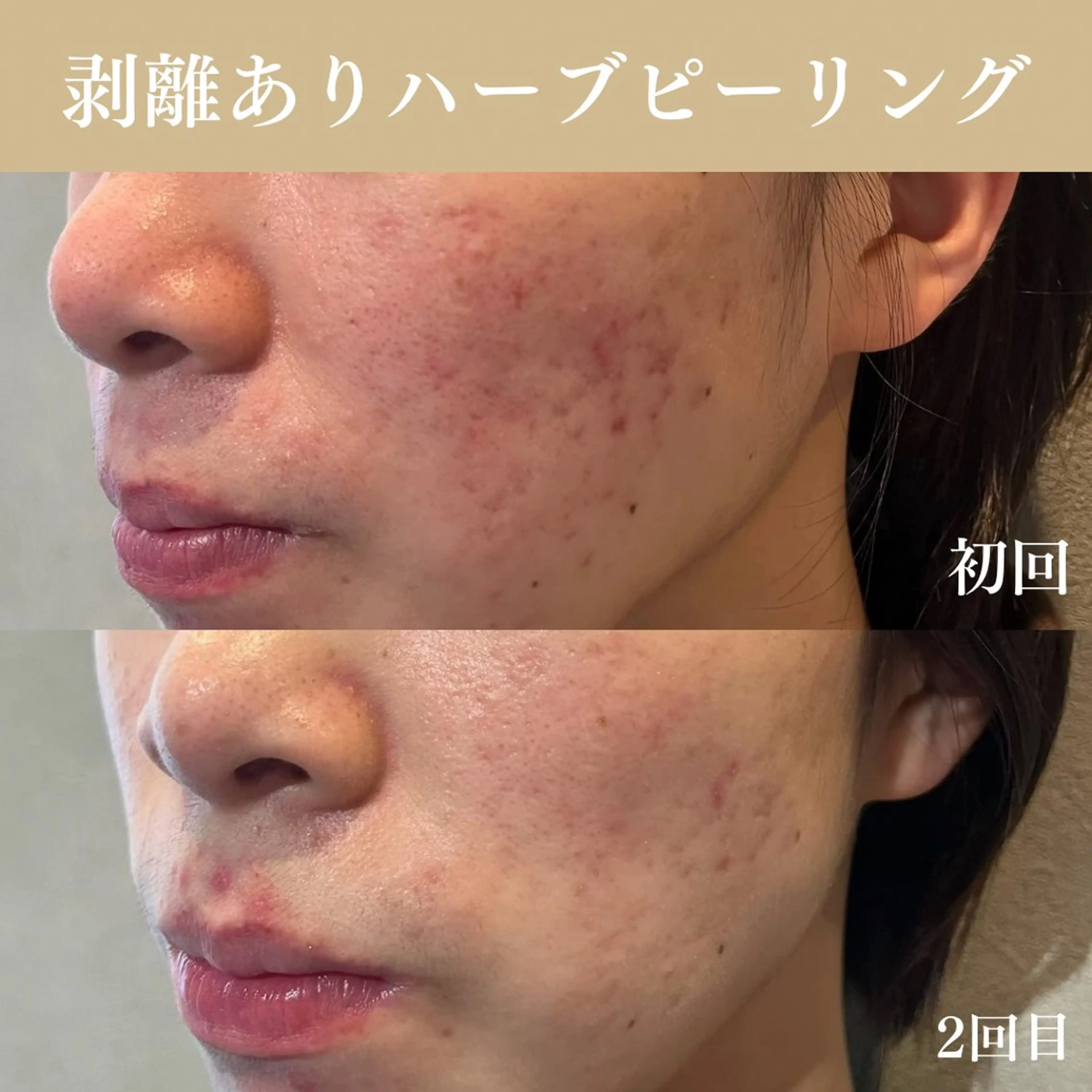 Oncebell. Bodymake&beautysalon所属・Oncebell. ワンベルのエステ・リラクイメージ