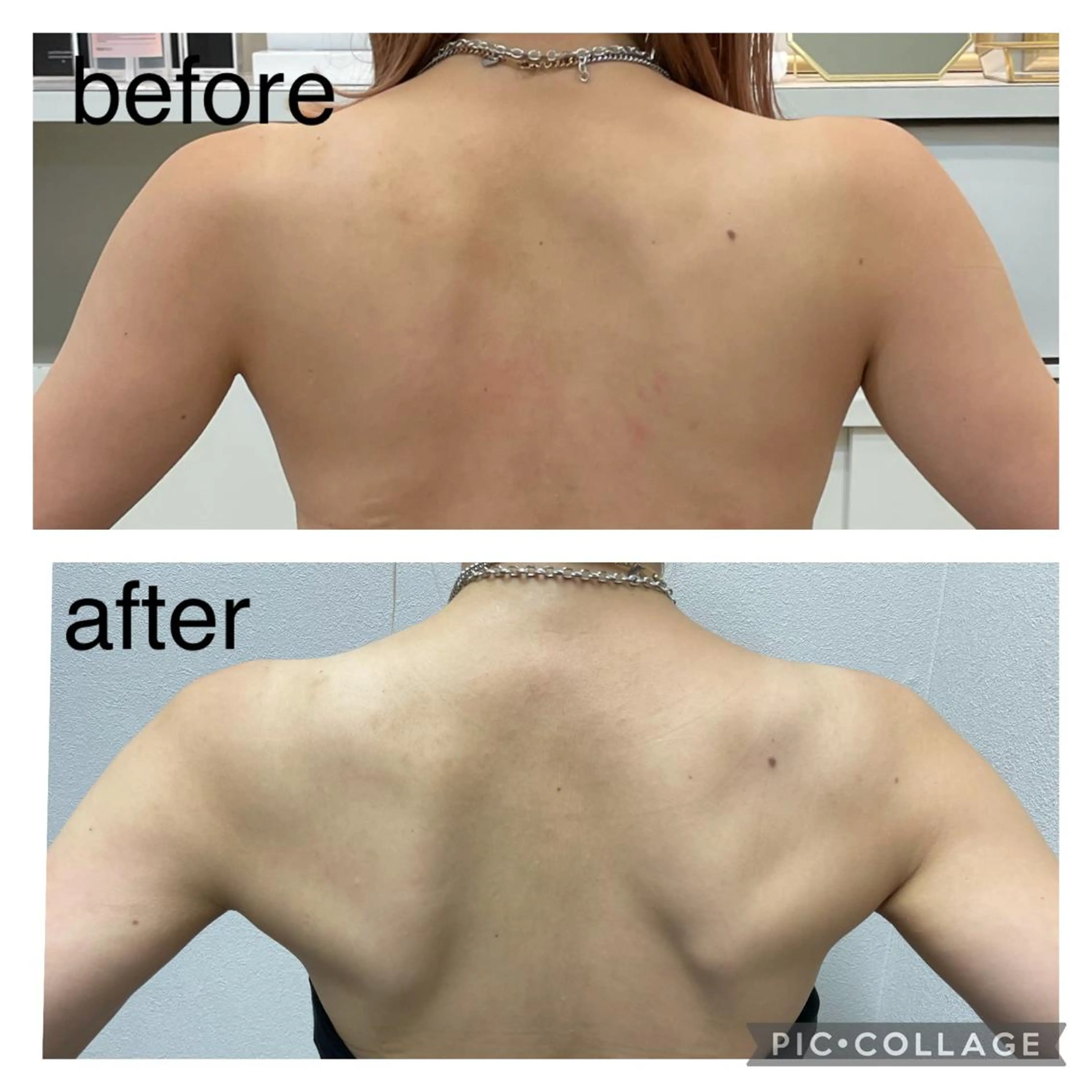 ENCHANT 脱毛.小顔.毛穴のエステ・リラクイメージ