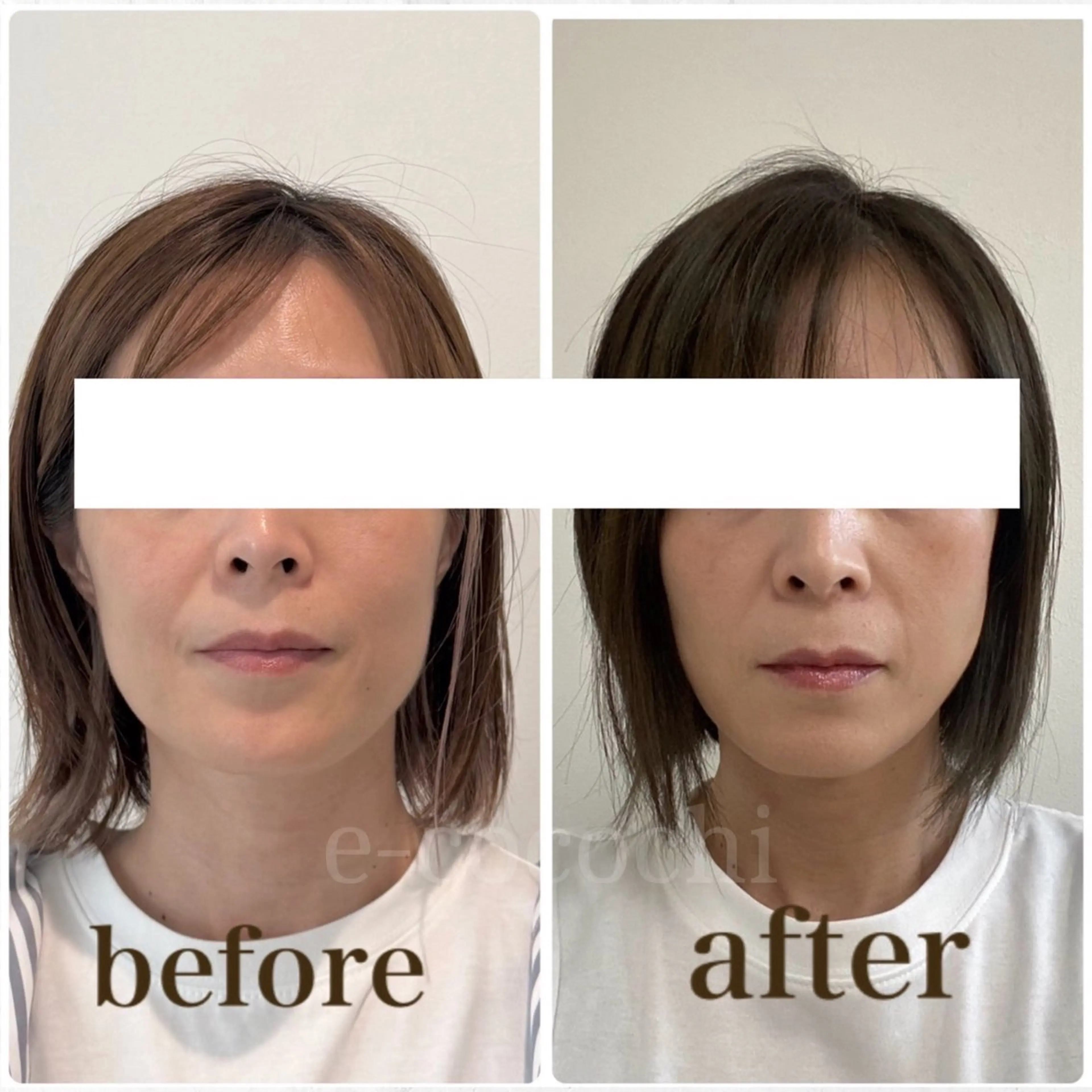 エステ リラク 小顔と ヘッドスパのお店のエステ・リラクイメージ