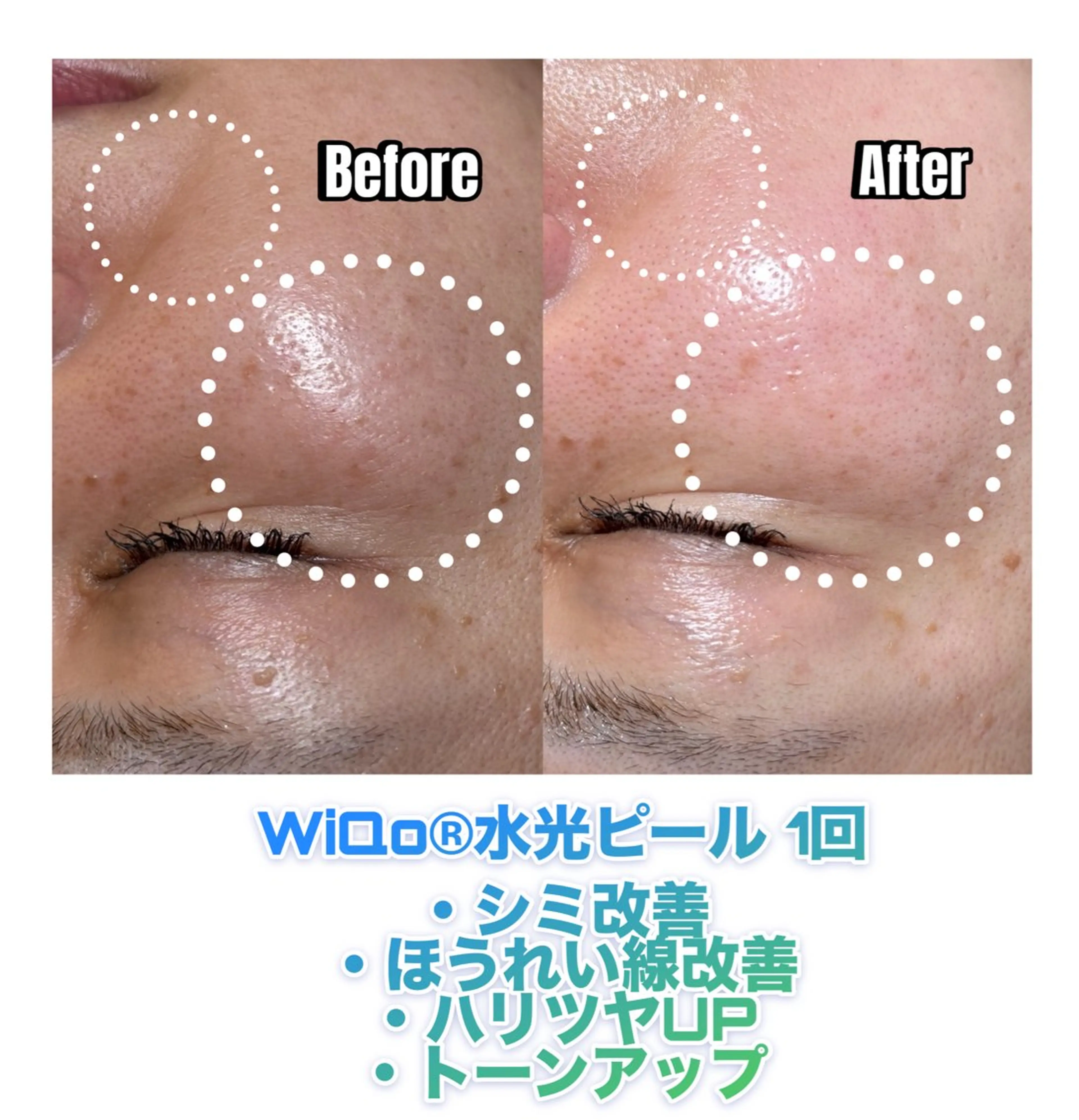 エステ 美肌・痩身・脱毛当日 予約◎ZENITHのエステ・リラクイメージ