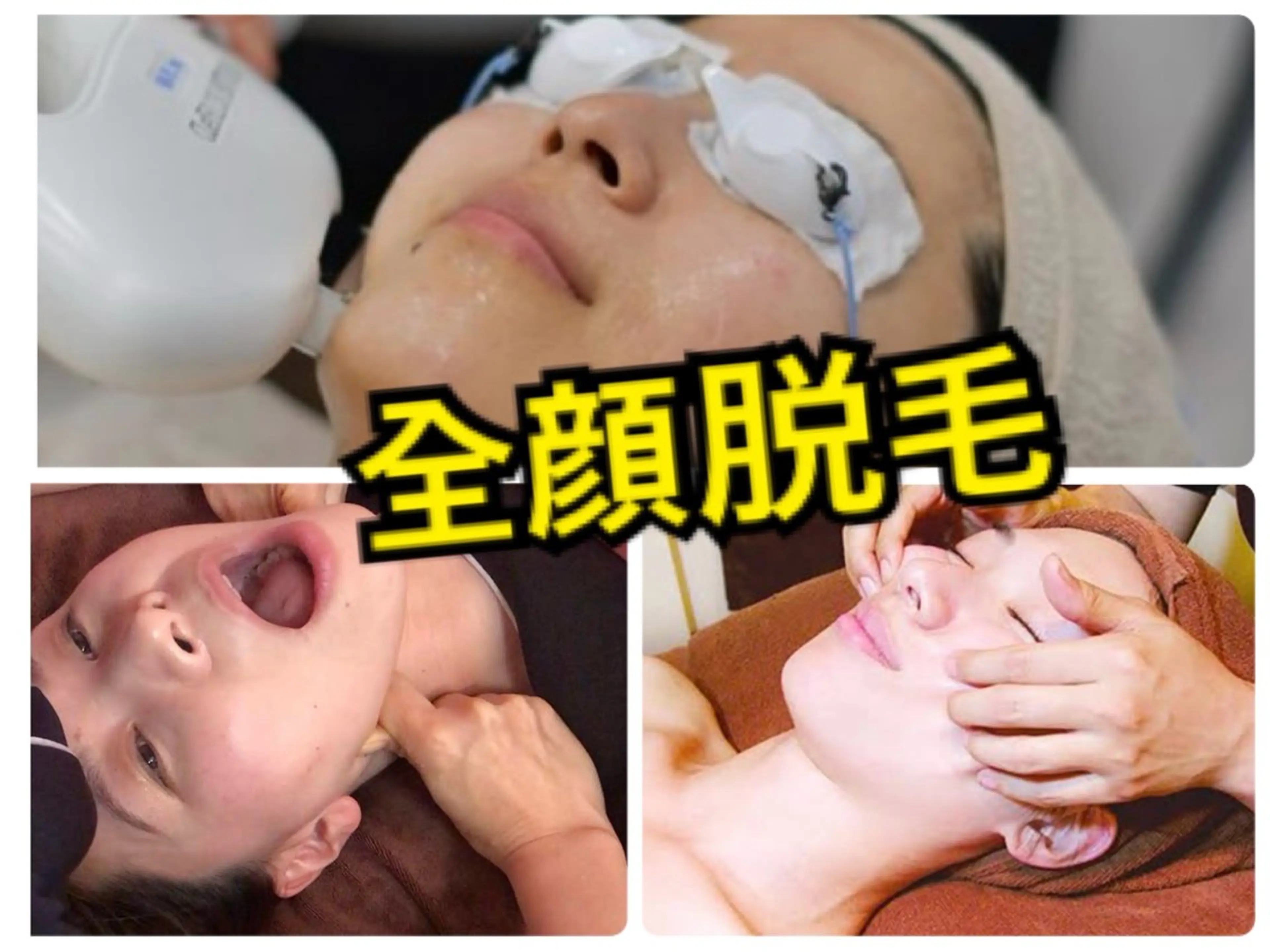 【ご褒美エステ】全顔脱毛+毛穴洗浄+小顔コルギ+角質取り+美白パックの写真