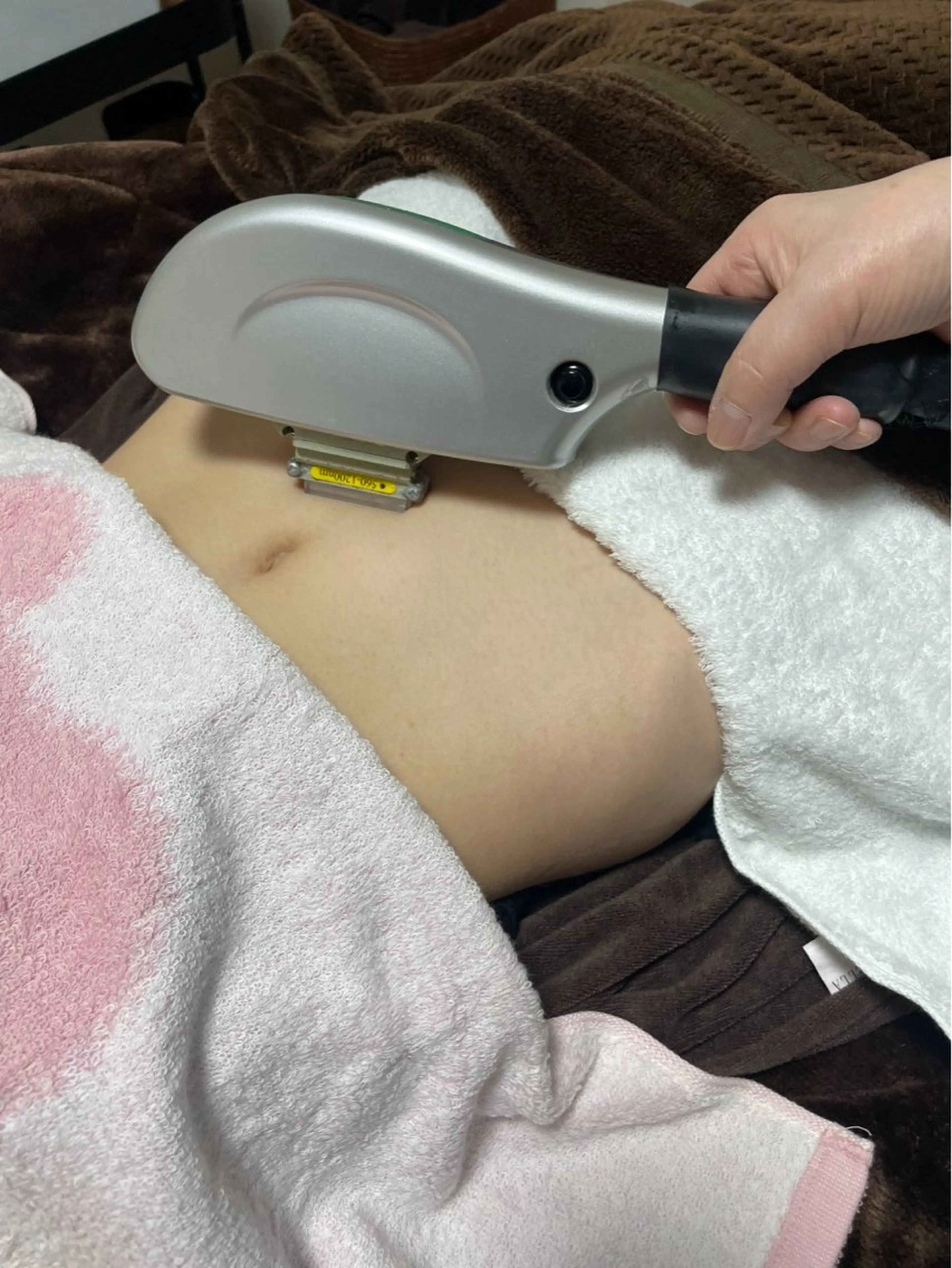 人気 No.1👍   VIO脱毛1回コース（Vライン、Iライン、Oライン)3箇所1回コース!!です。(女性限定)の写真