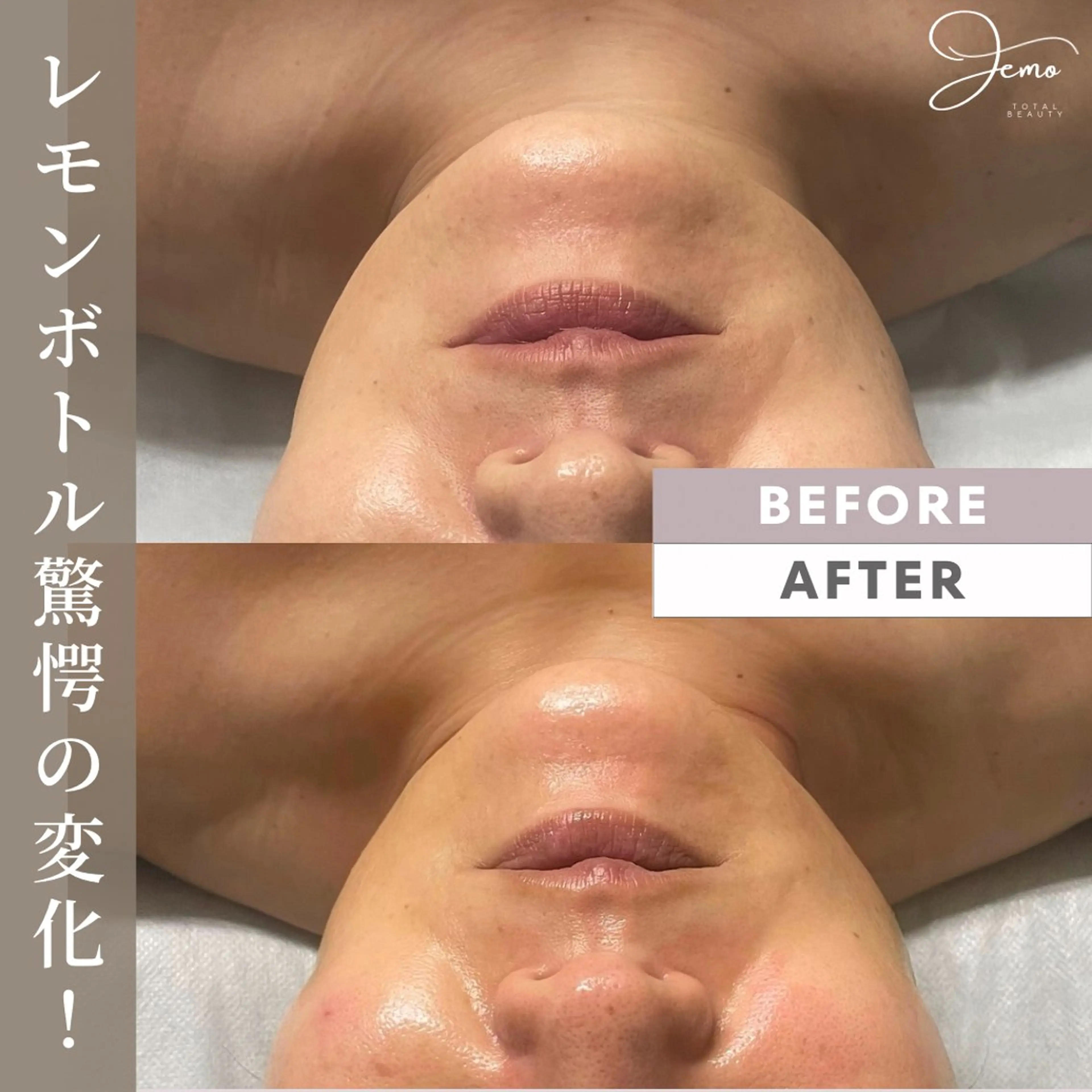 脱毛&増毛&肌管理サロンJemo所属・脱毛増毛肌管理サロン Jemoのエステ・リラクイメージ