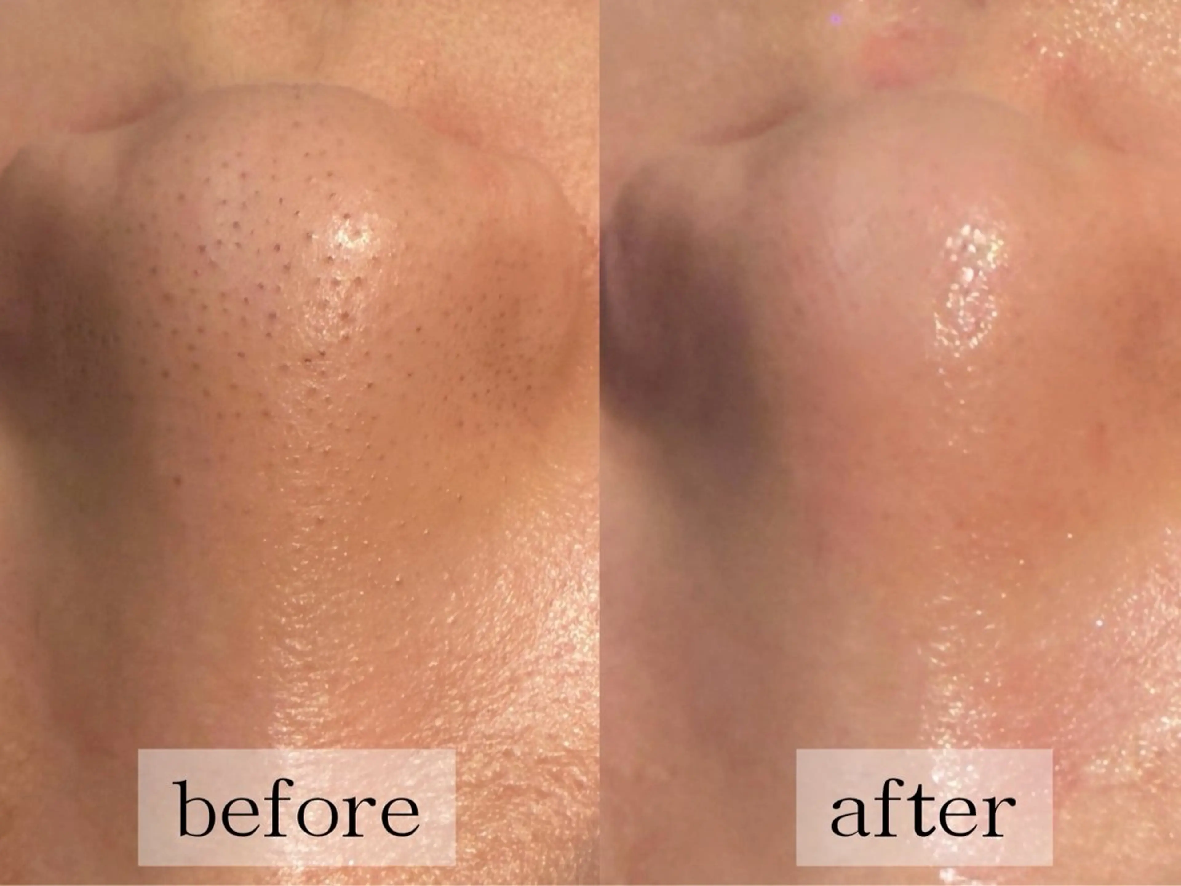 毛穴・肌質ケア専門 グランビューティーのエステ・リラクイメージ