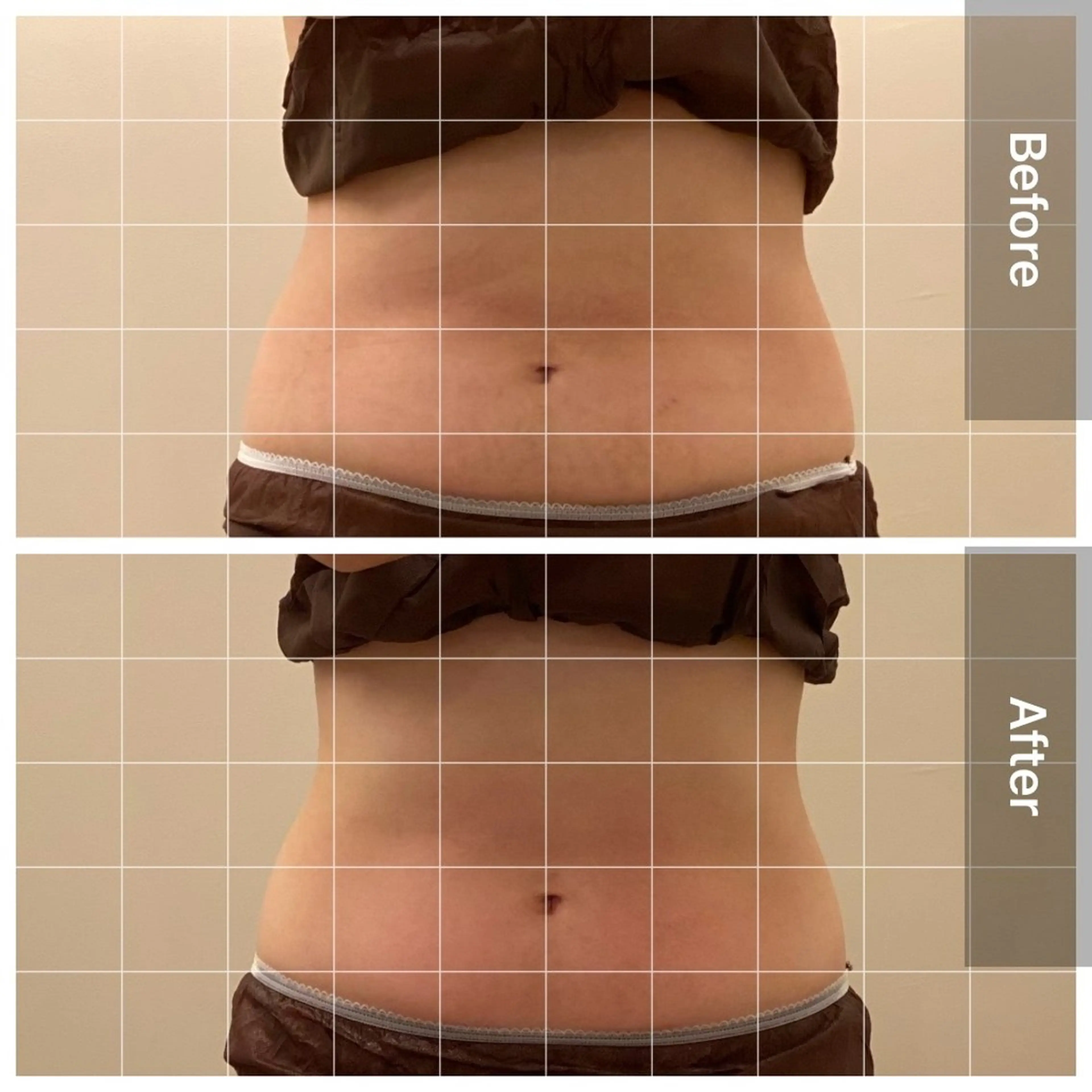 美容鍼/ヘッドスパ/ 💎さかもとのエステ・リラクイメージ