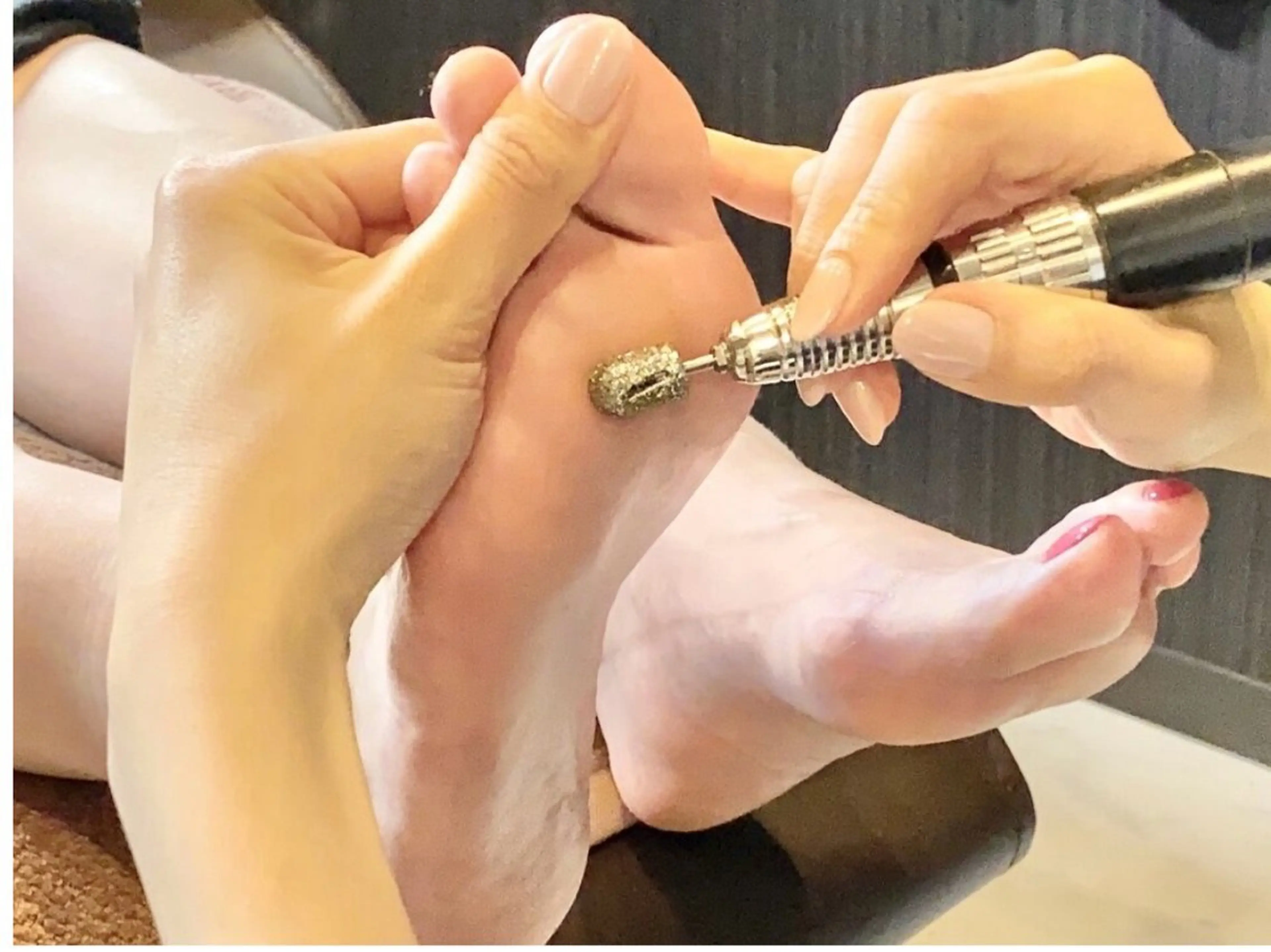 【限定５名/応援価格】フットエイジングケアの写真