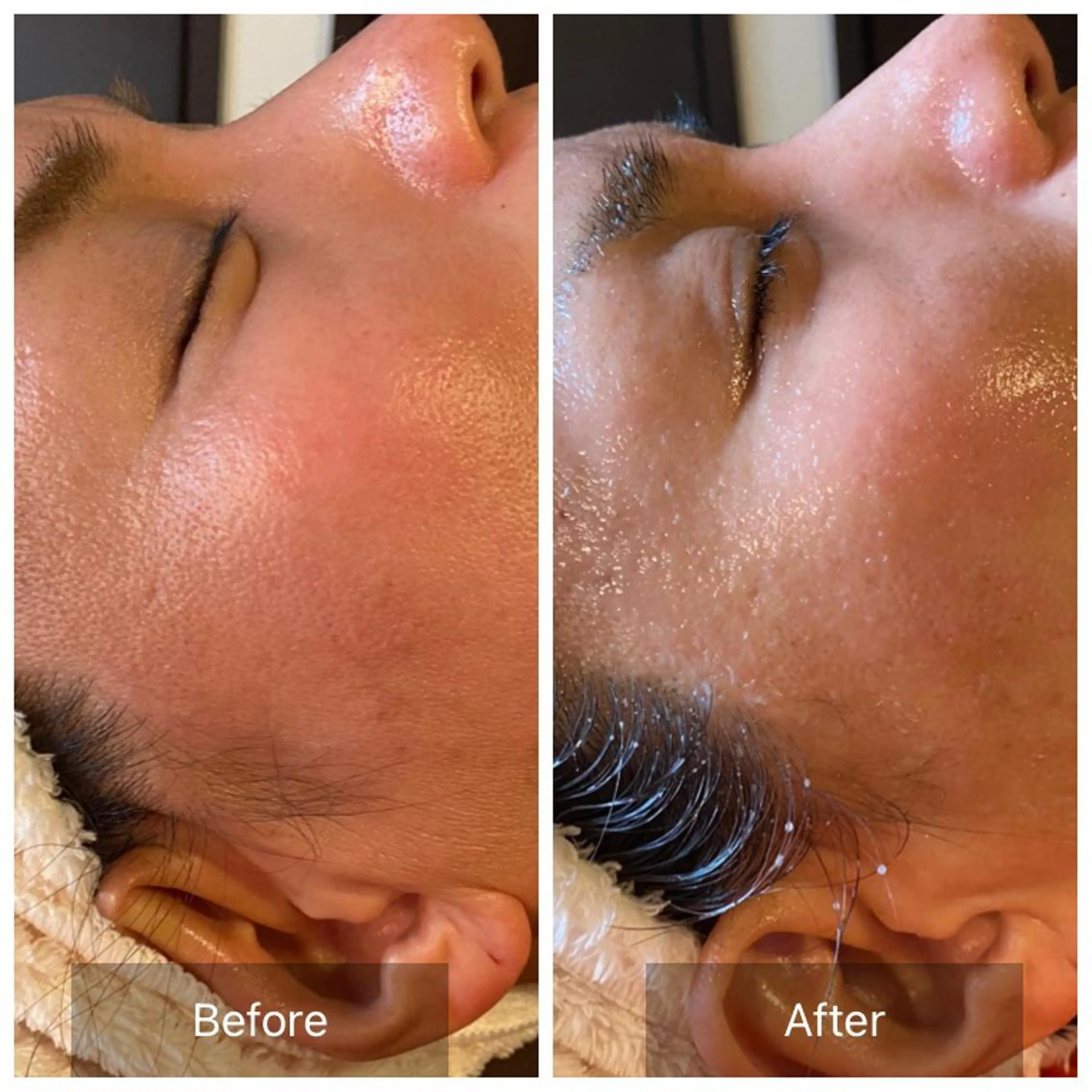 Mandarin Orange所属・毛穴から始める肌メン テマンダリンオレンジのエステ・リラクイメージ