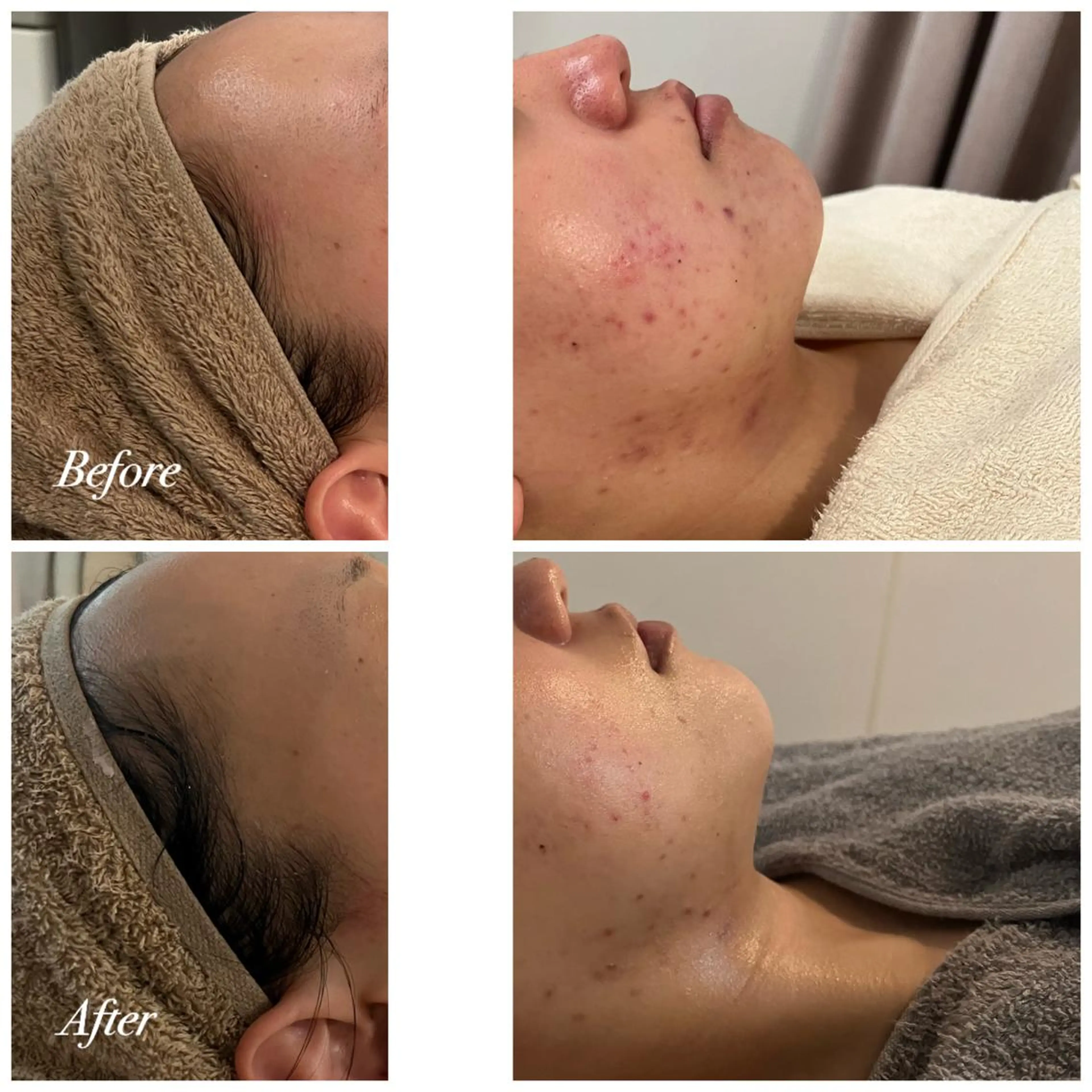 エステ リラク Plaran 〜プララン 〜のその他イメージ