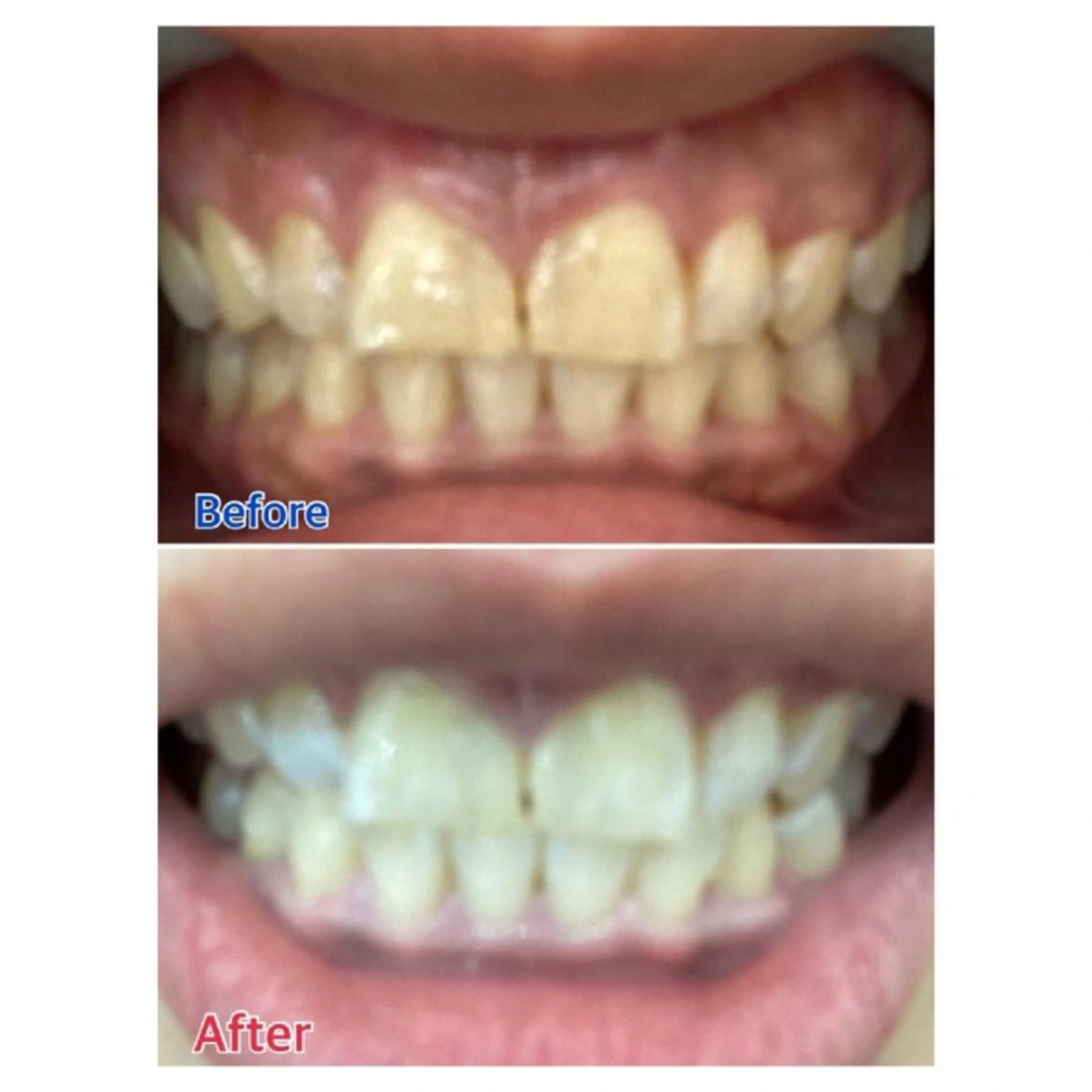 M渋谷店所属・Ｍ渋谷 ホワイトニングのその他イメージ