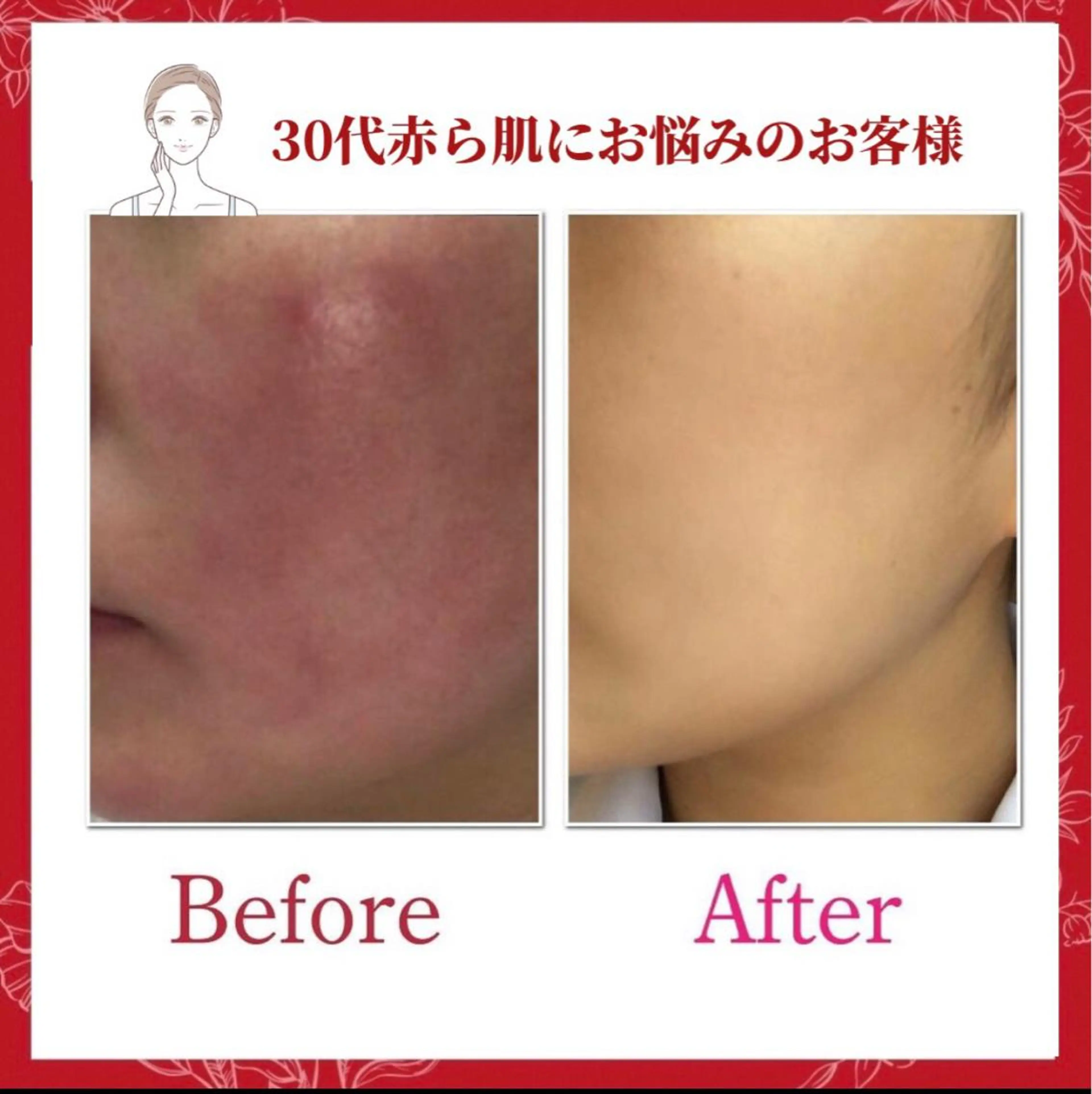 美容医療提携 サロンドシェリーのエステ・リラクイメージ