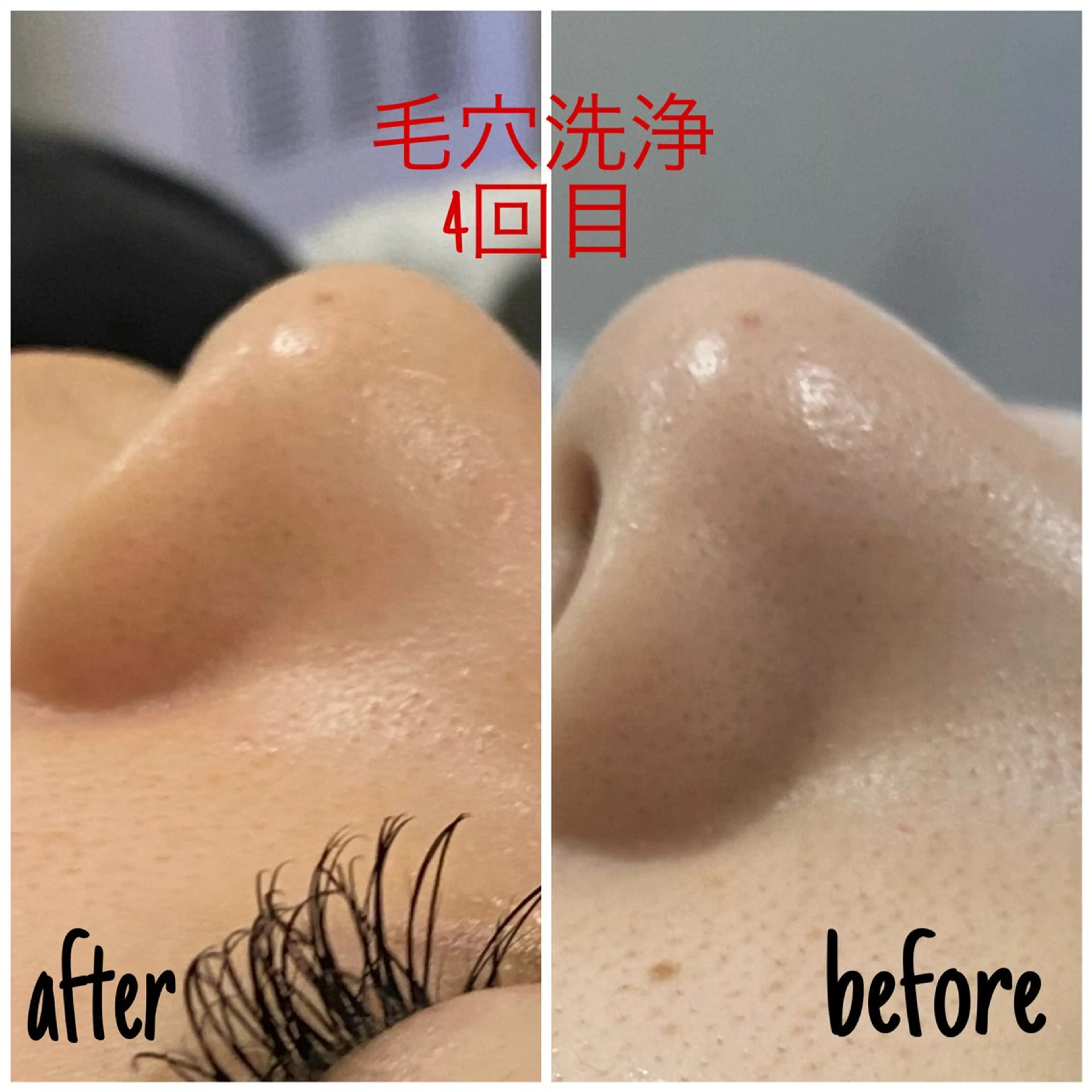 エステ 毛穴洗浄・痩身・脱毛 /アルカンジュのエステ・リラクイメージ