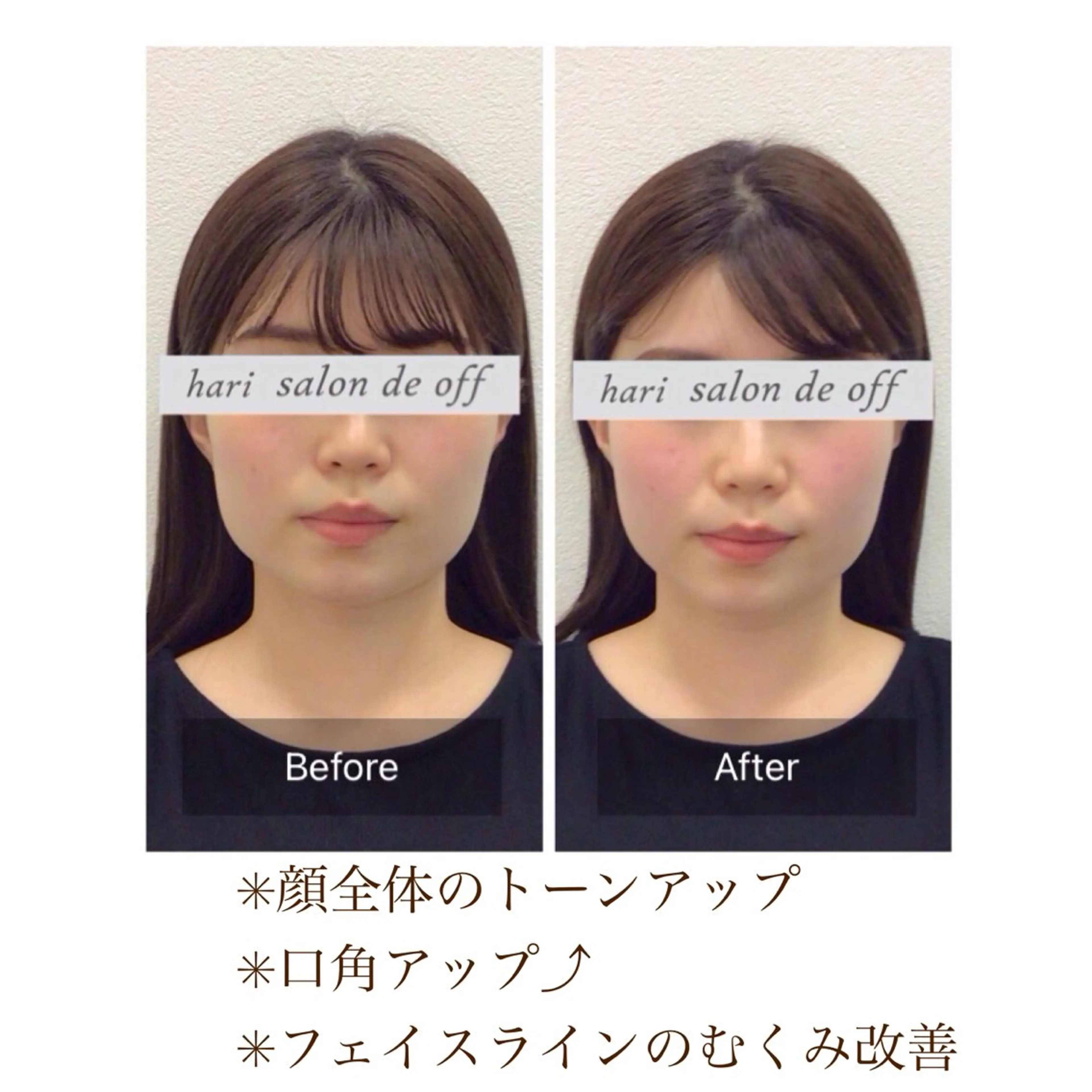 エステ リラク 整体×美容鍼灸 鍼灸師Miyanoのエステ・リラクイメージ