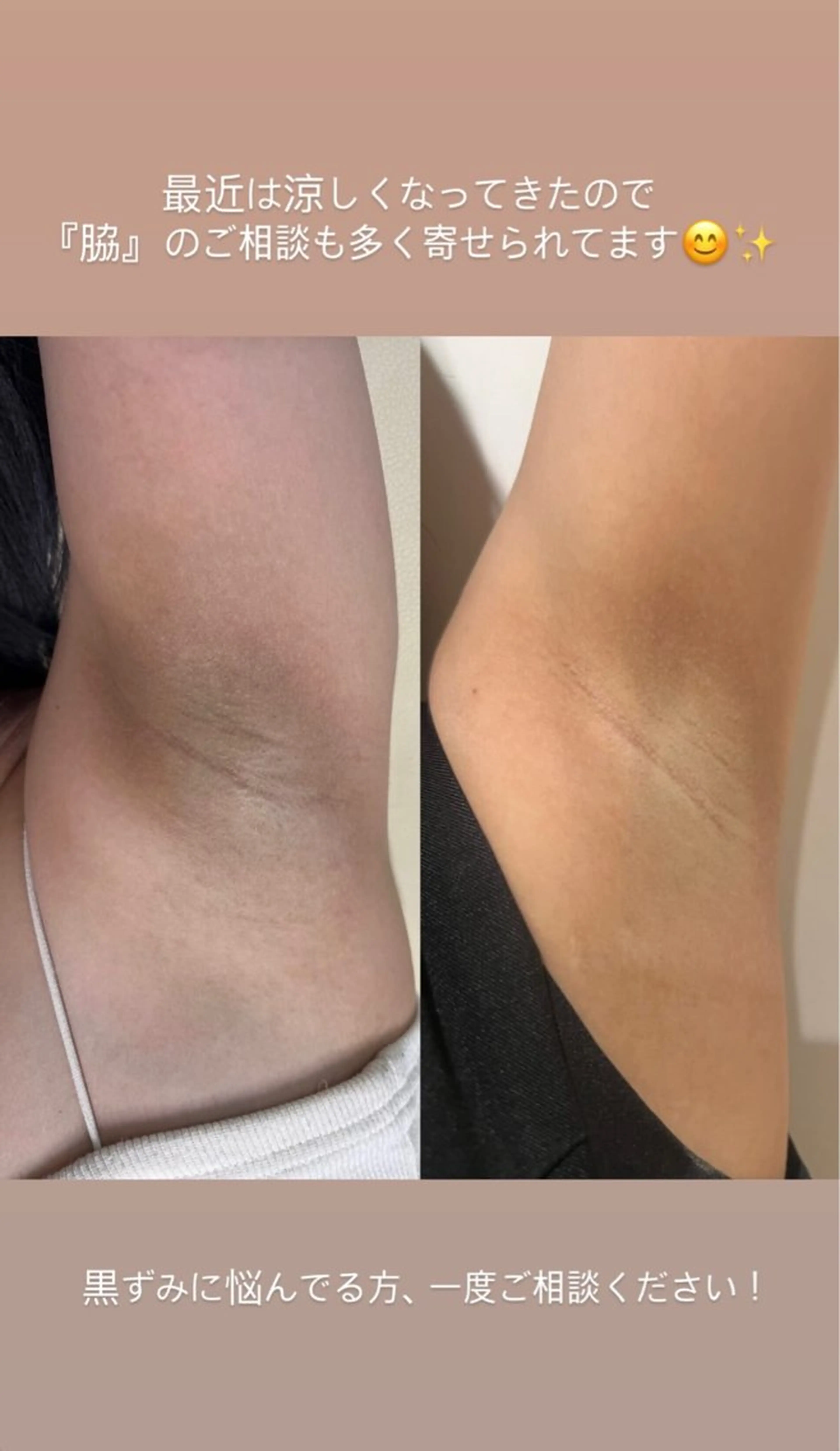 エステサロン-mignon-所属・mignon 脱毛/ ローマピンク/耳ツボのその他イメージ