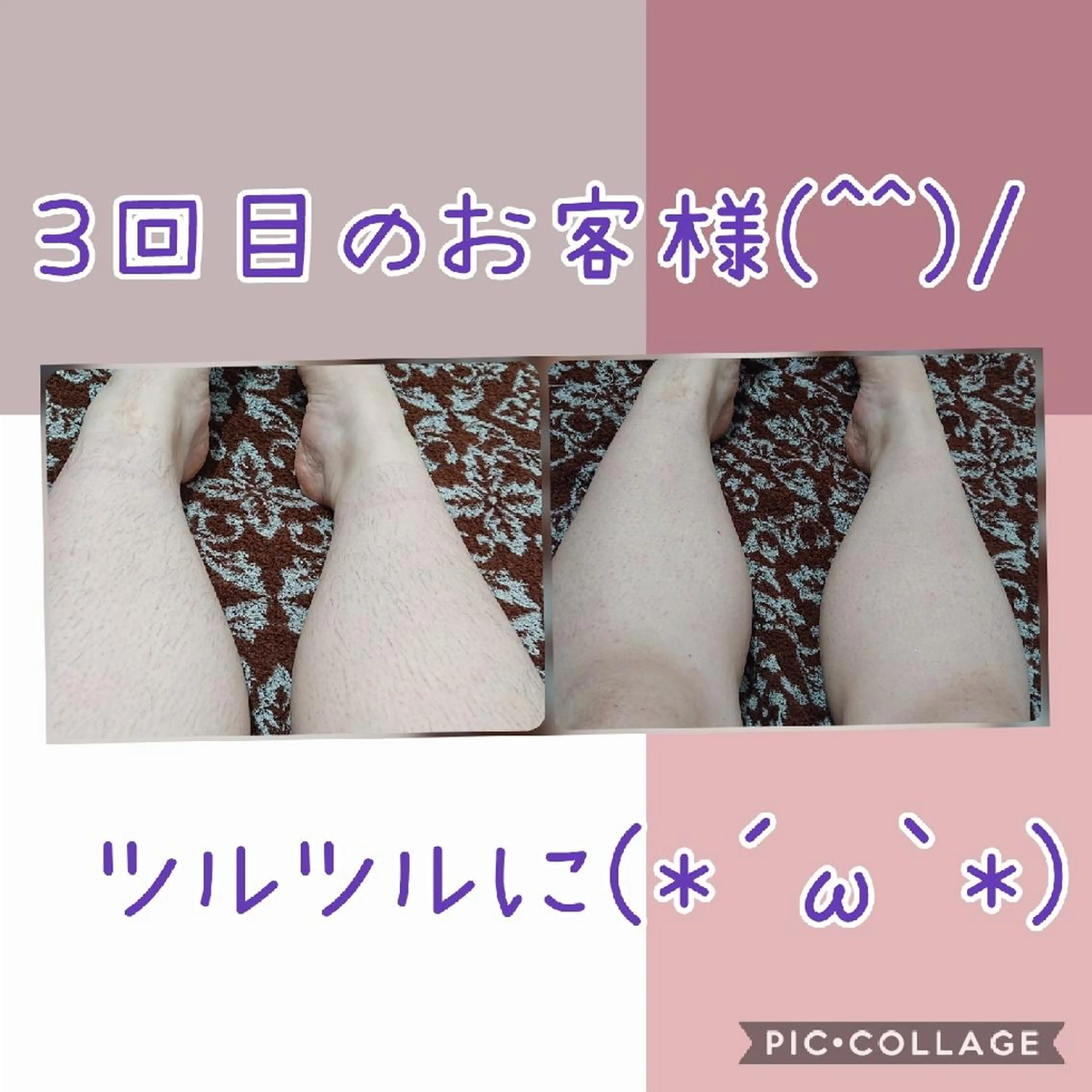 脱毛 リラクゼーション ふわりのエステ・リラクイメージ