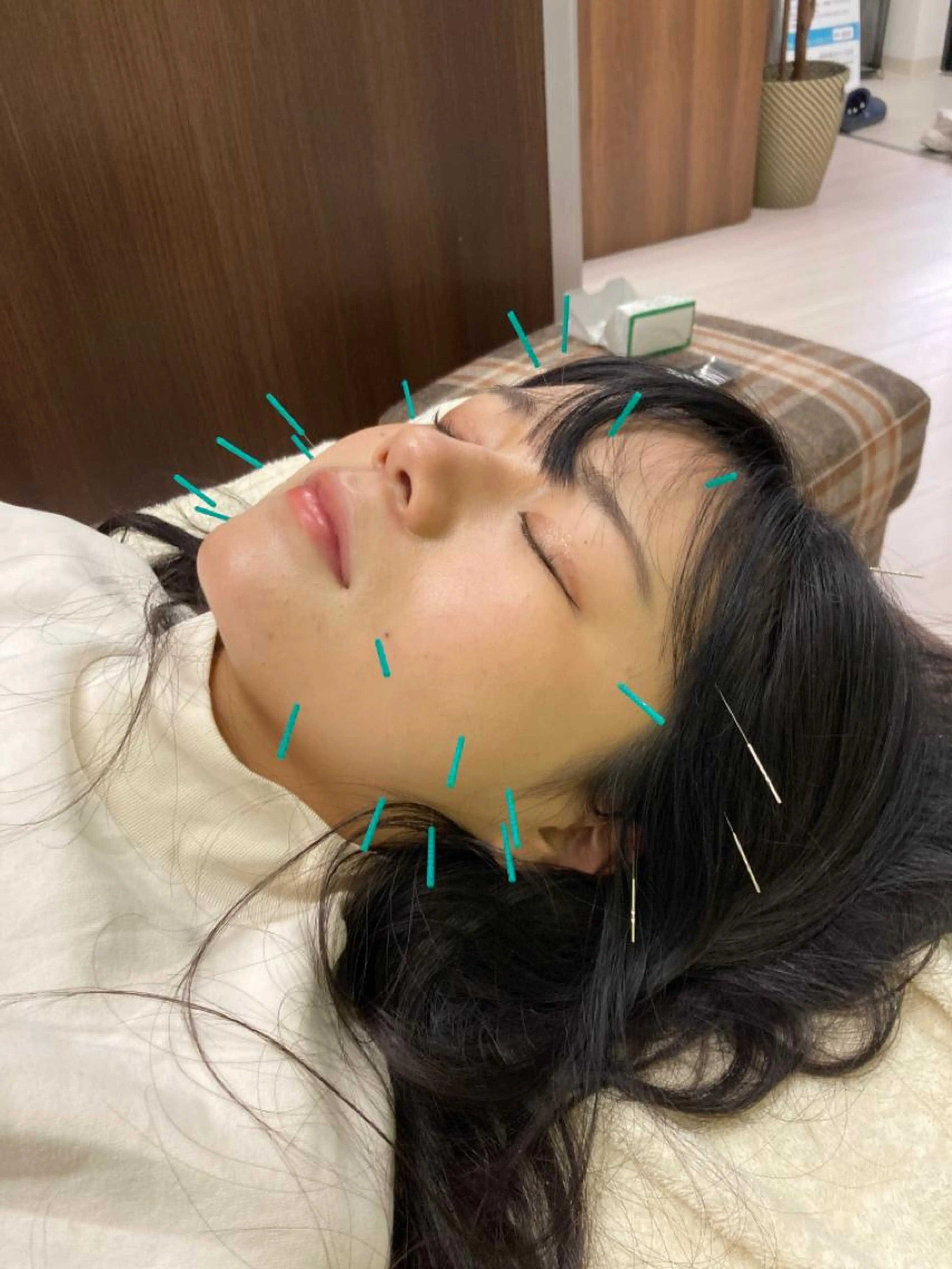 美顔はり×40分の写真