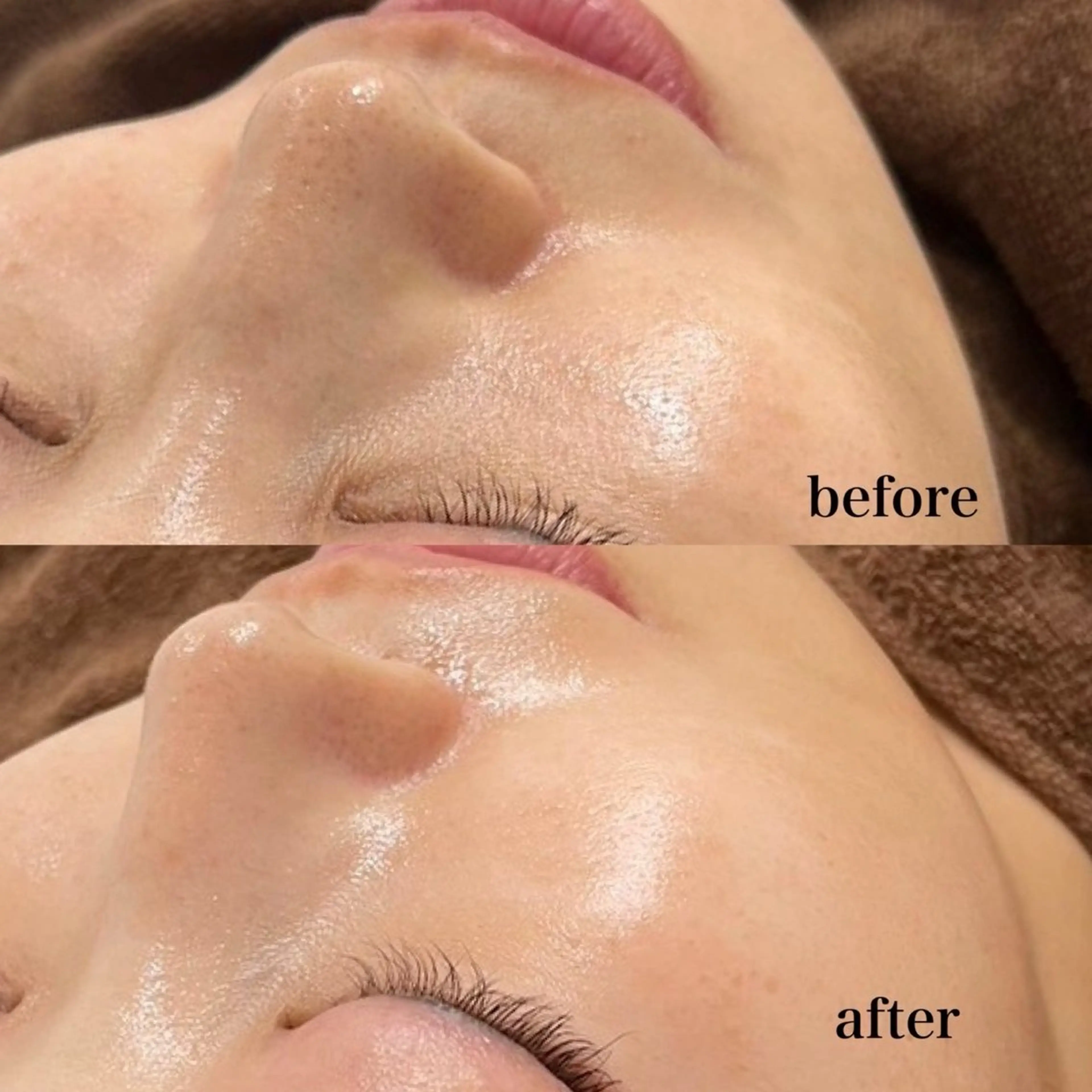 エステ 韓国肌管理専門店　White labo 梅田店所属・大西 亜季のエステ・リラクイメージ