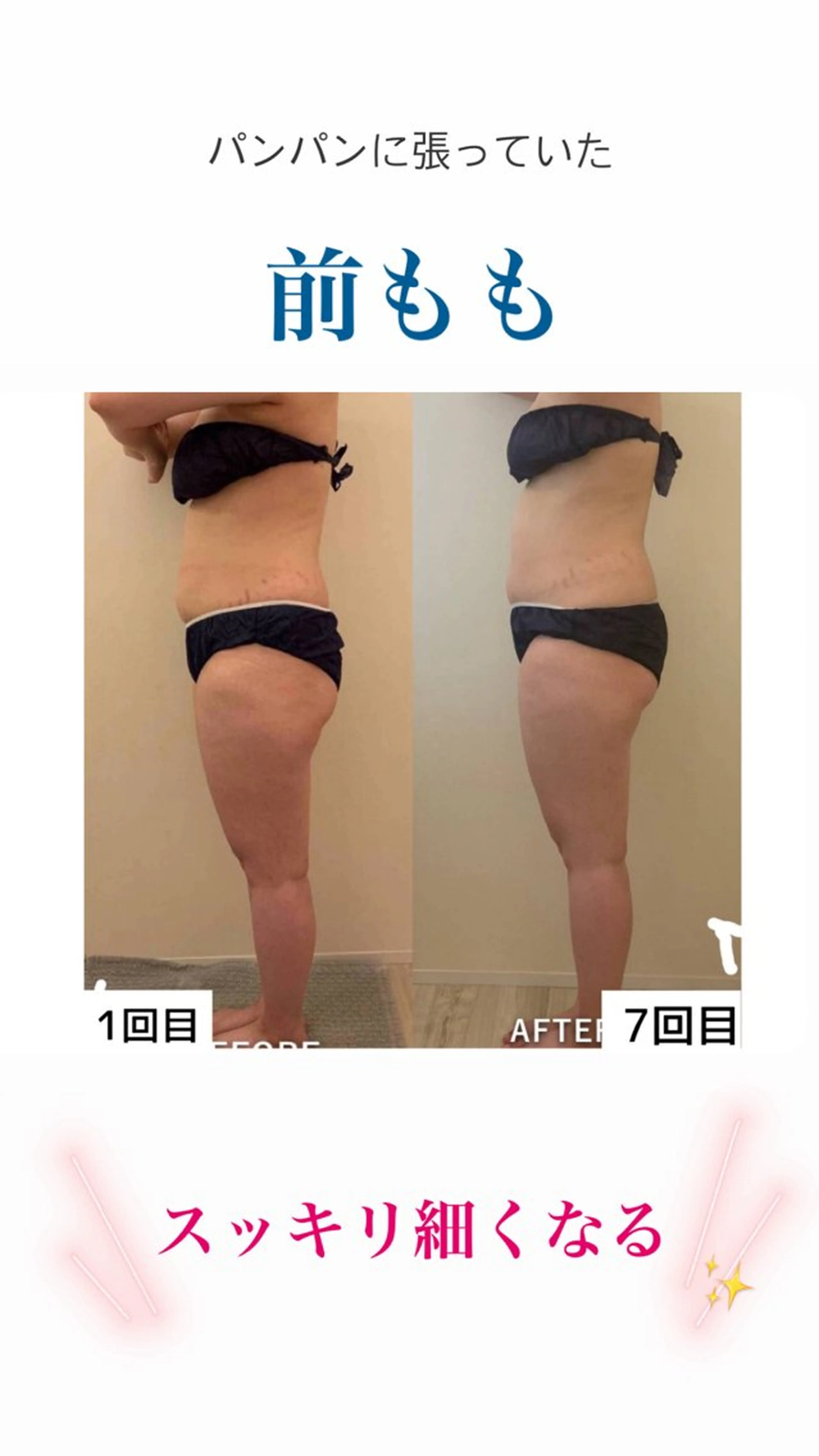 産後ダイエット−9㎏ Pourvous結衣のエステ・リラクイメージ