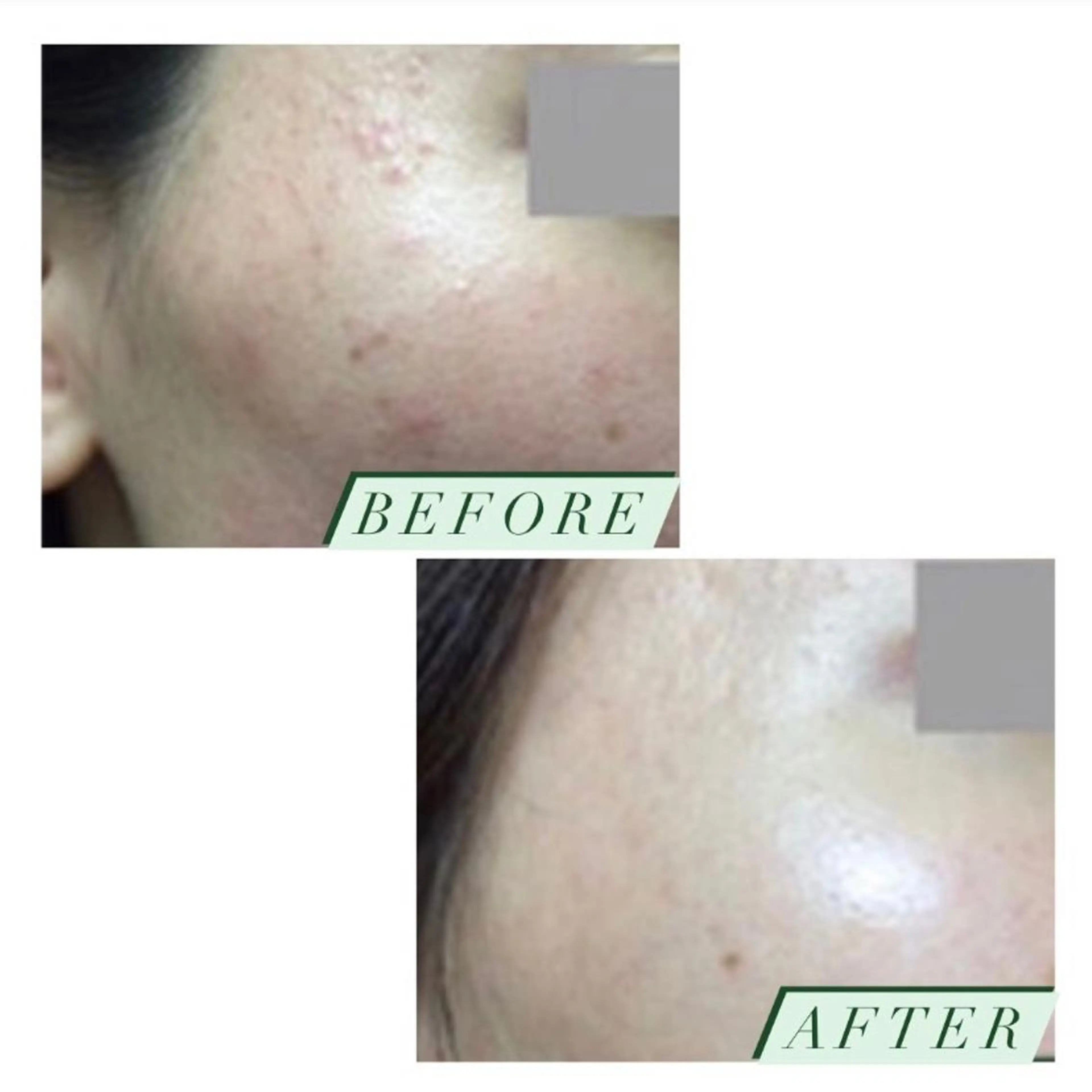 ハーブピーリング・毛穴ケア専門サロンSalon de LENA所属・ハーブピーリング 専門店/名古屋駅前店のその他イメージ