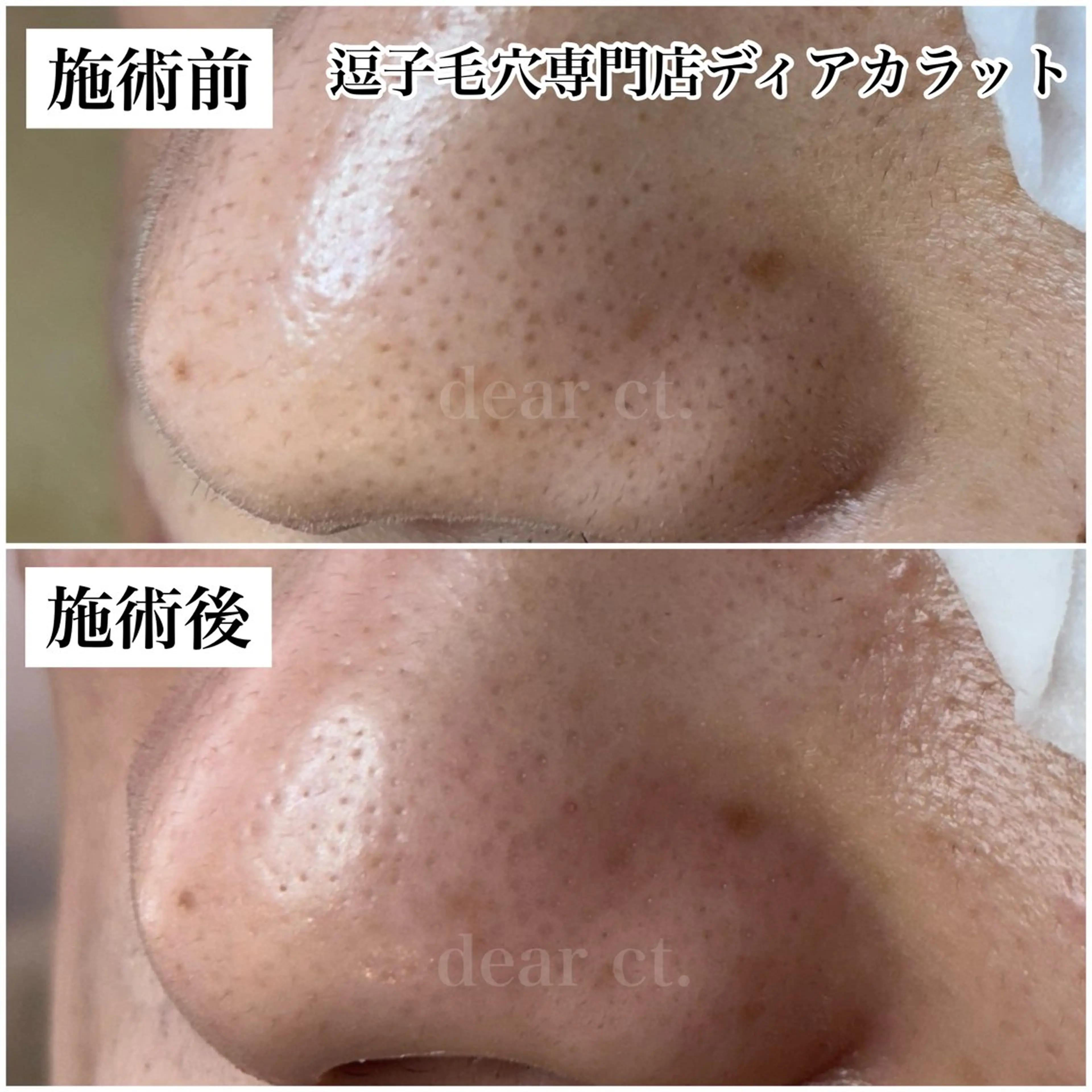 エステ リラク 毛穴専門店　dear Ct.所属・毛穴専門店 ディアカラットのエステ・リラクイメージ