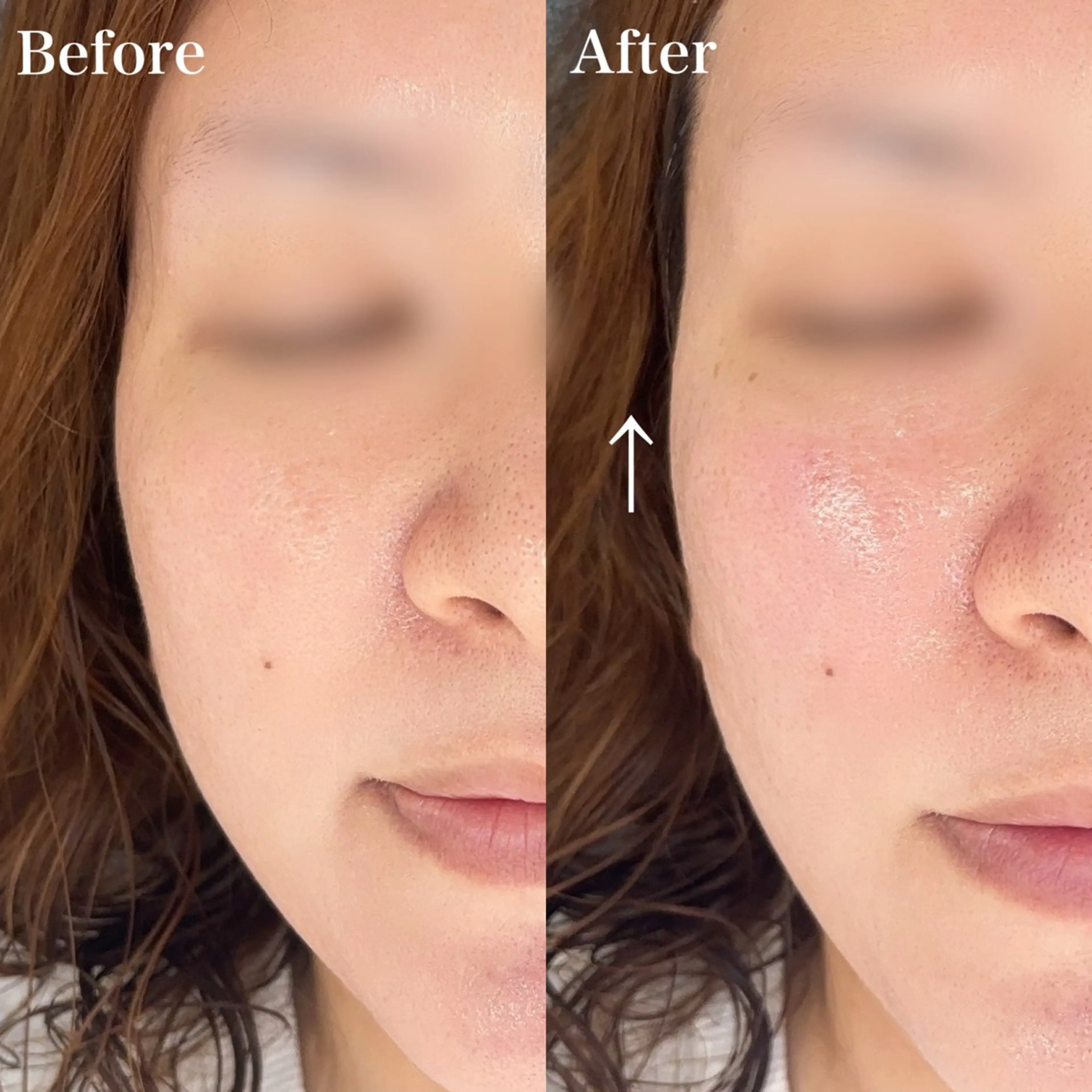 エステ fino.所属・野崎 麻由美の眉毛・アイブロウイメージ