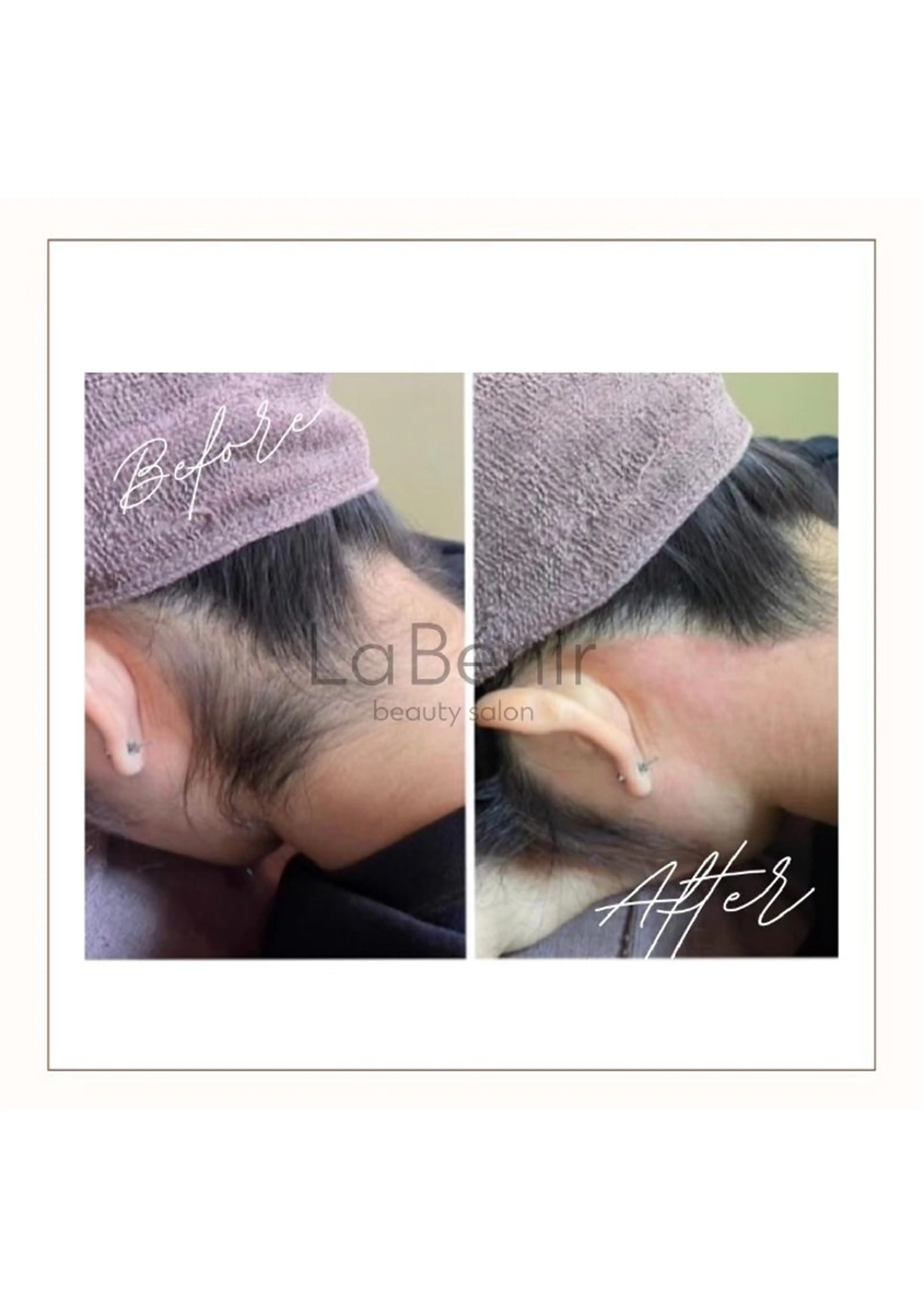 脱毛/美肌【皮膚科看 護師経営】ラベニールのエステ・リラクイメージ