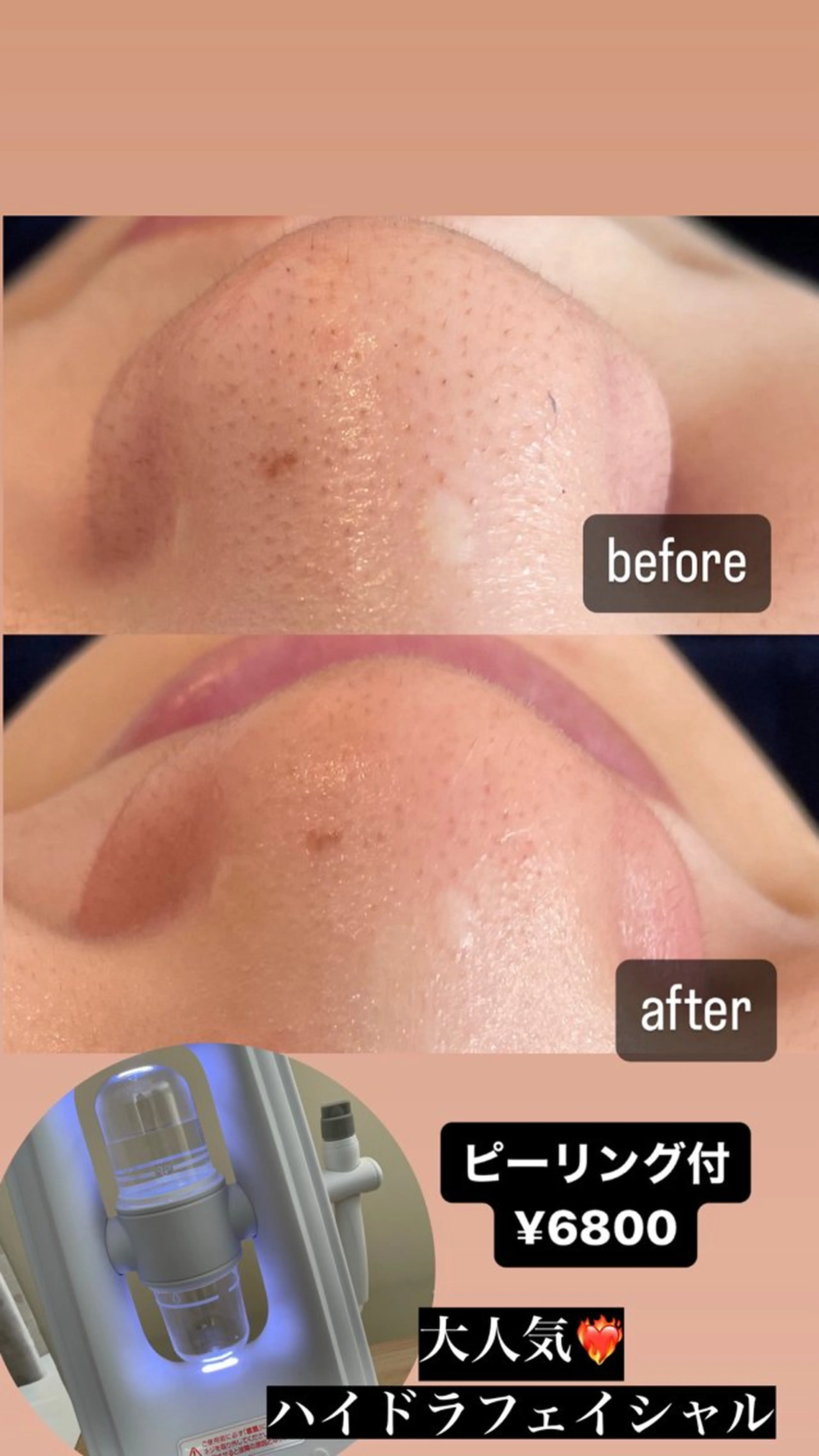 エステ VERY VERY九条店所属・VERY VERY 九条店のエステ・リラクイメージ