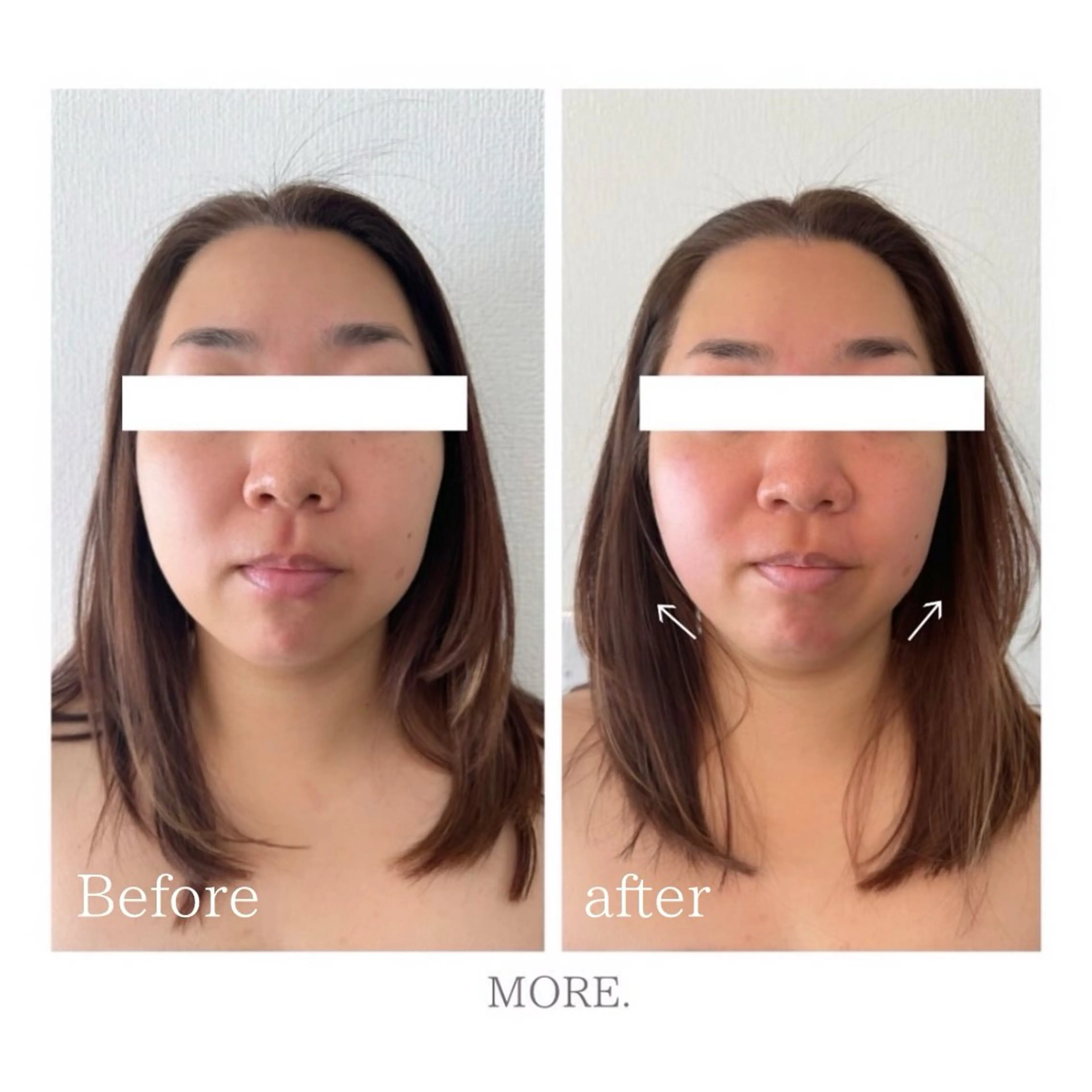 MORE. NEMAのエステ・リラクイメージ