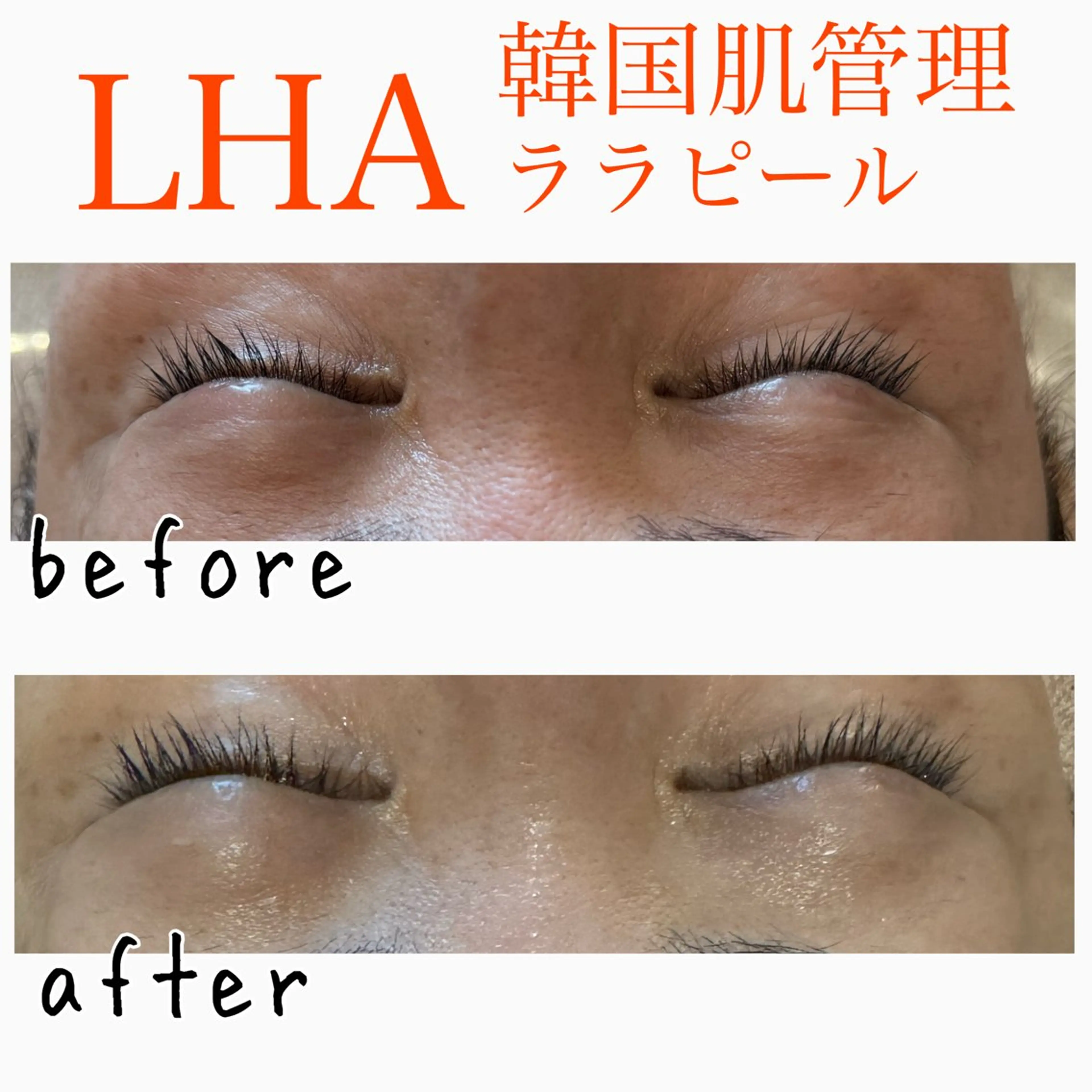 美肌脱毛と癒しのﾌﾟﾗｲﾍﾞｰﾄｻﾛﾝ。gratia~ｸﾞﾚｲﾃｨｱ~所属・gratia ~ｸﾞﾚｲﾃｨｱ~のエステ・リラクイメージ