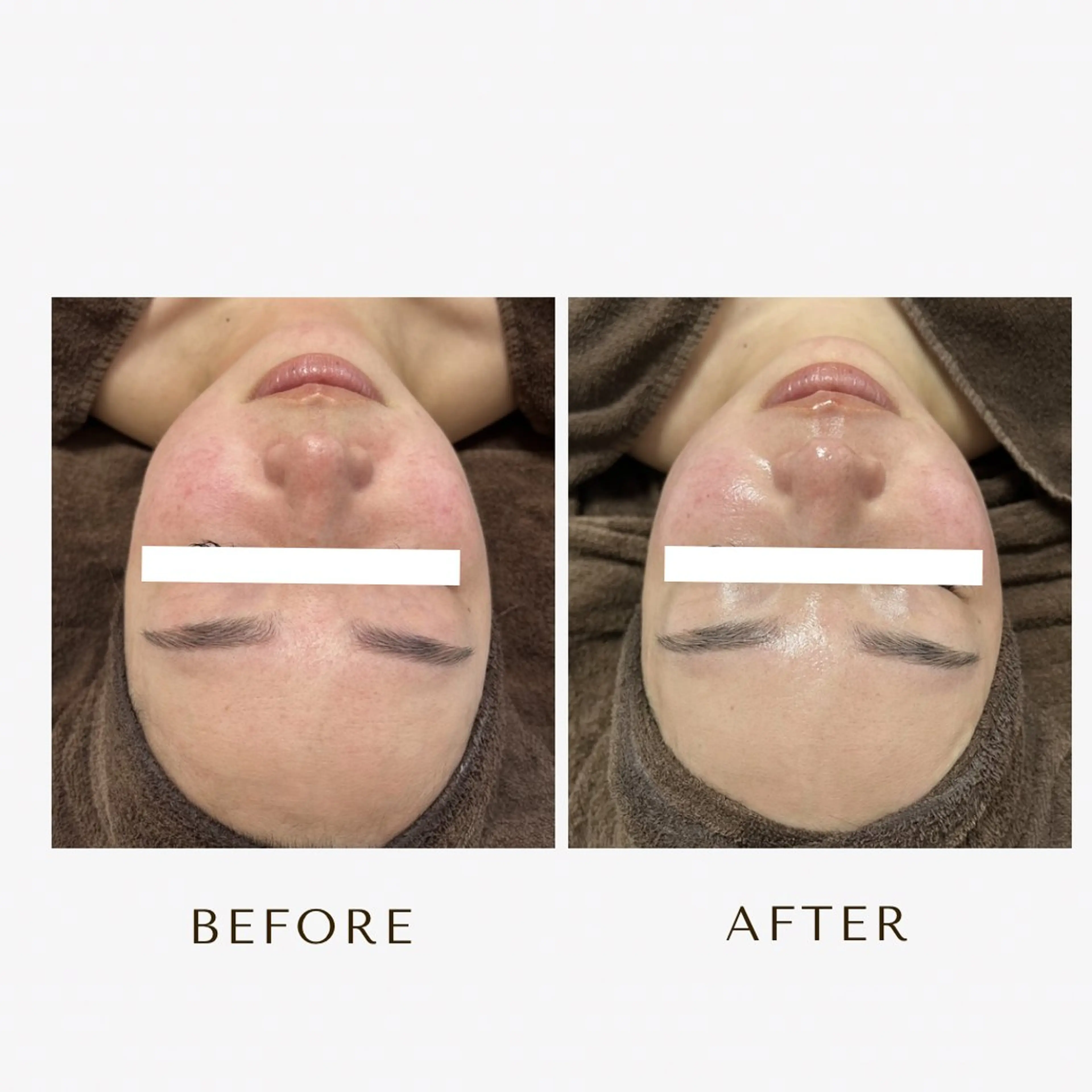 脱毛 1st｜フェイシャル エステ専門店のエステ・リラクイメージ