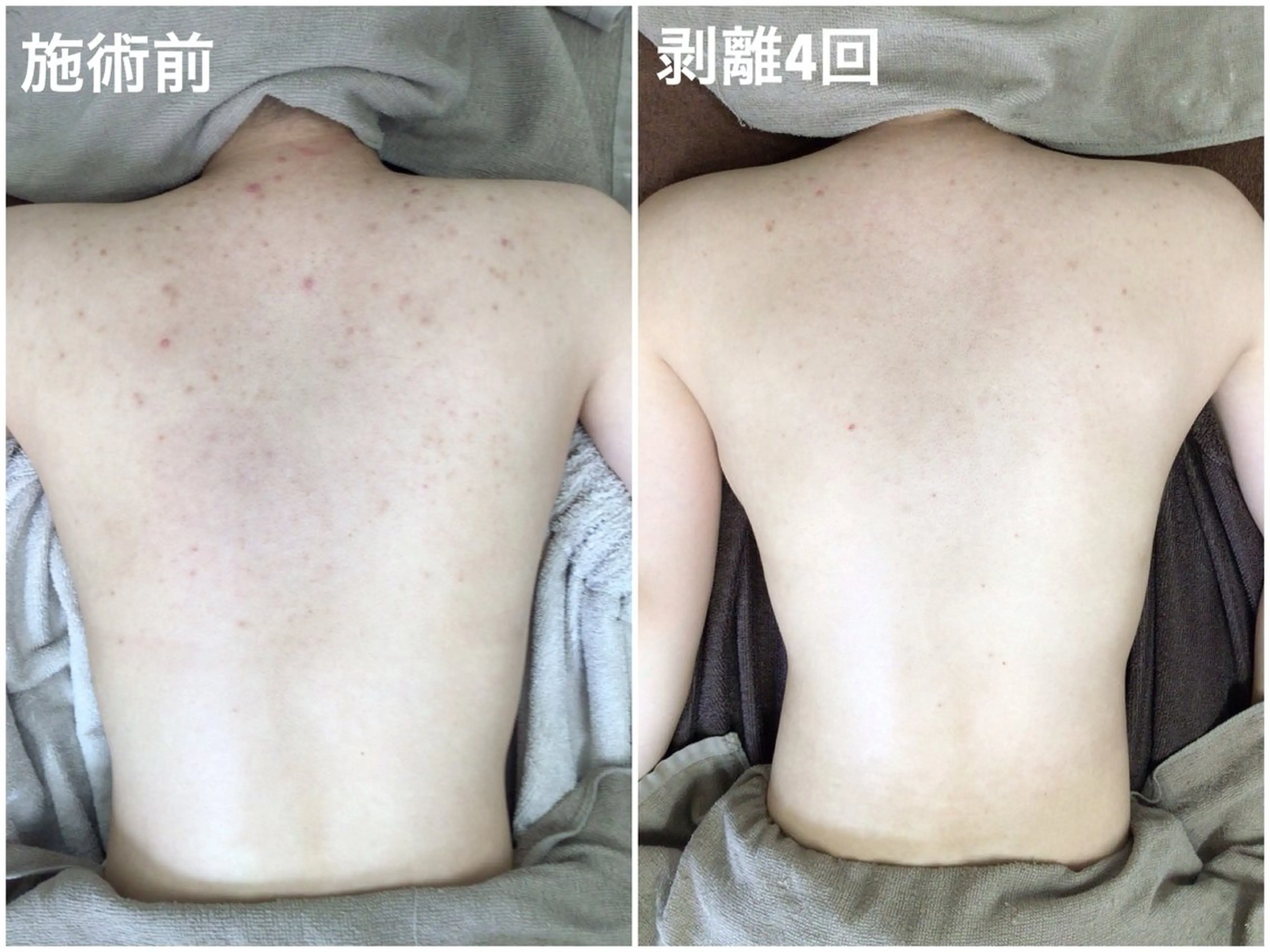 ハーブピーリング専門 エミルカ船橋のエステ・リラクイメージ