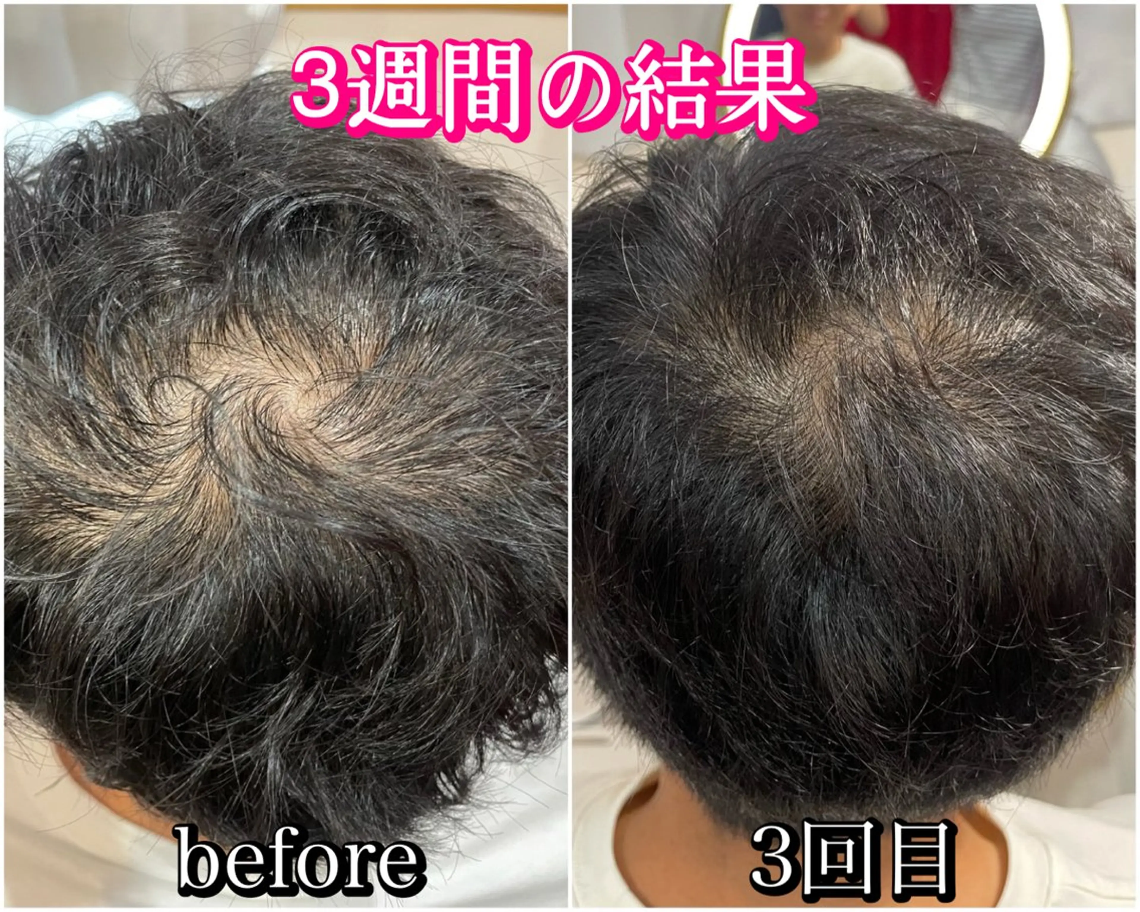 毛穴レス ハーブ＆ ワックス脱毛×光脱毛のエステ・リラクイメージ