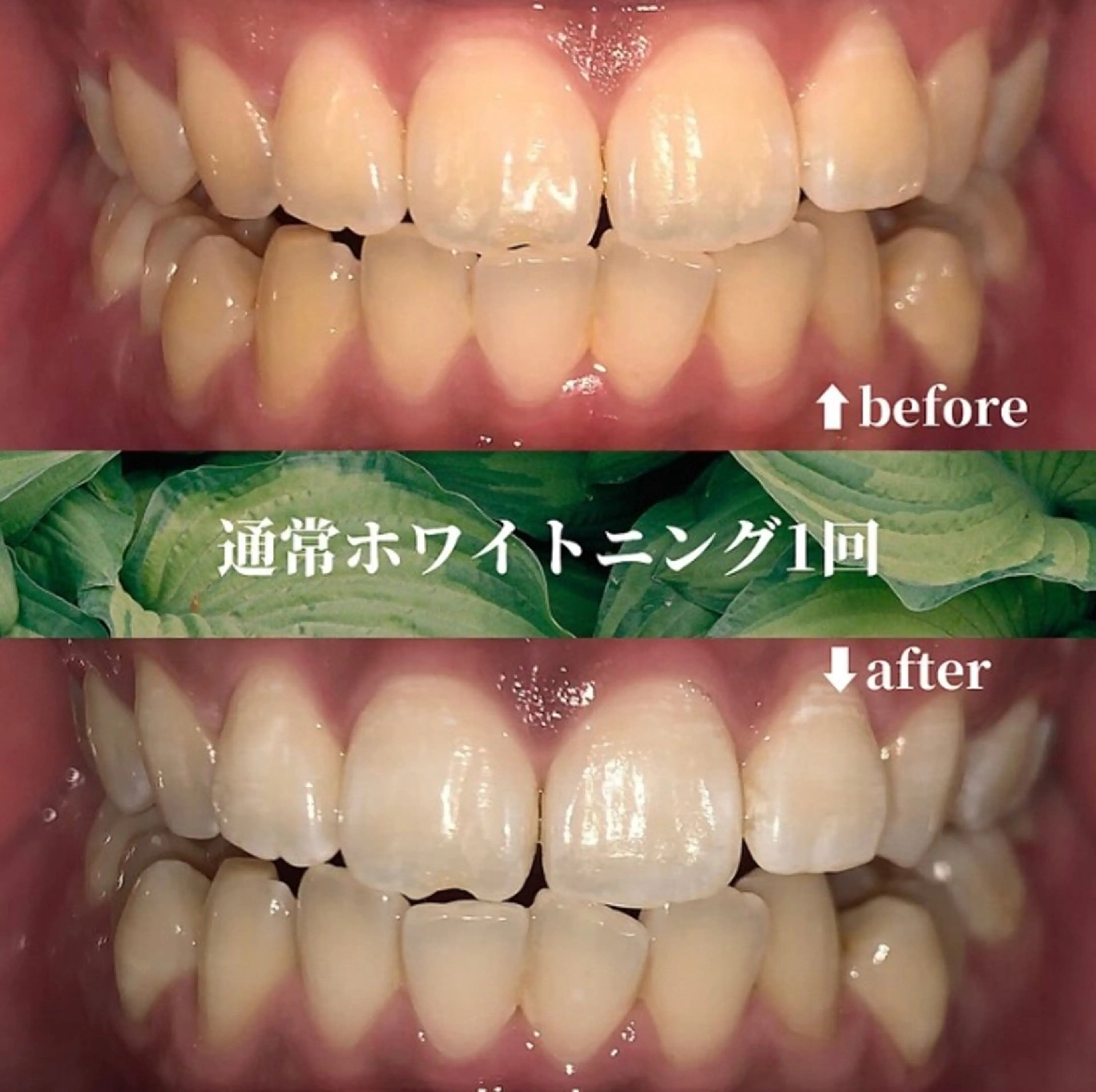 エステ futaba ホワイトニング/天神のエステ・リラクイメージ