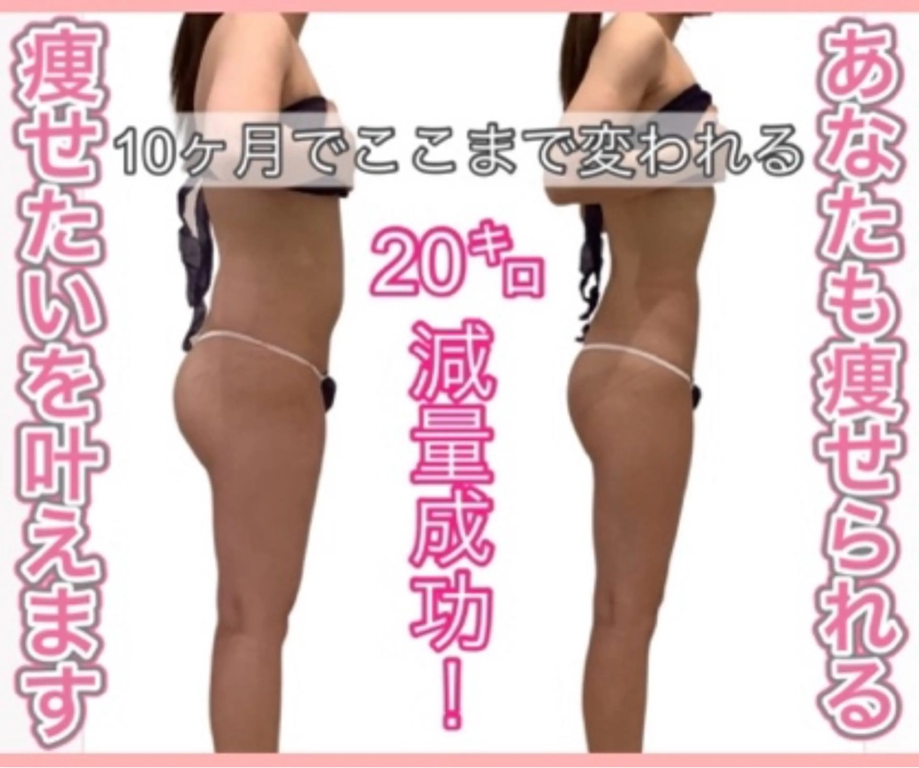 痩身ダイエット&小顔専門店Rs slim（アールズスリム）所属・痩身ダイエット&小顔 🩷アールズスリムのエステ・リラクイメージ