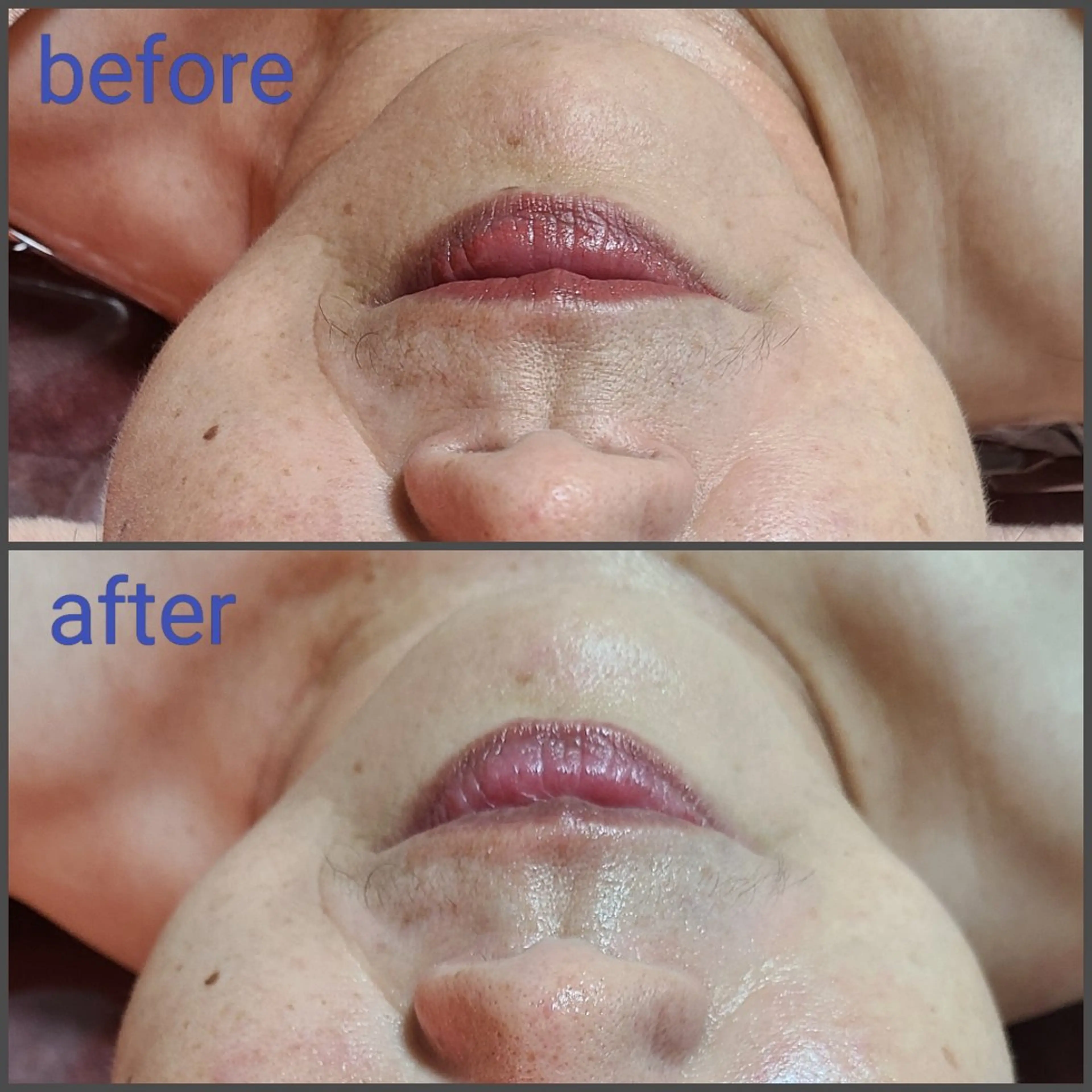 エステ 顔ツボ整顔セラピスト 三根百恵のエステ・リラクイメージ