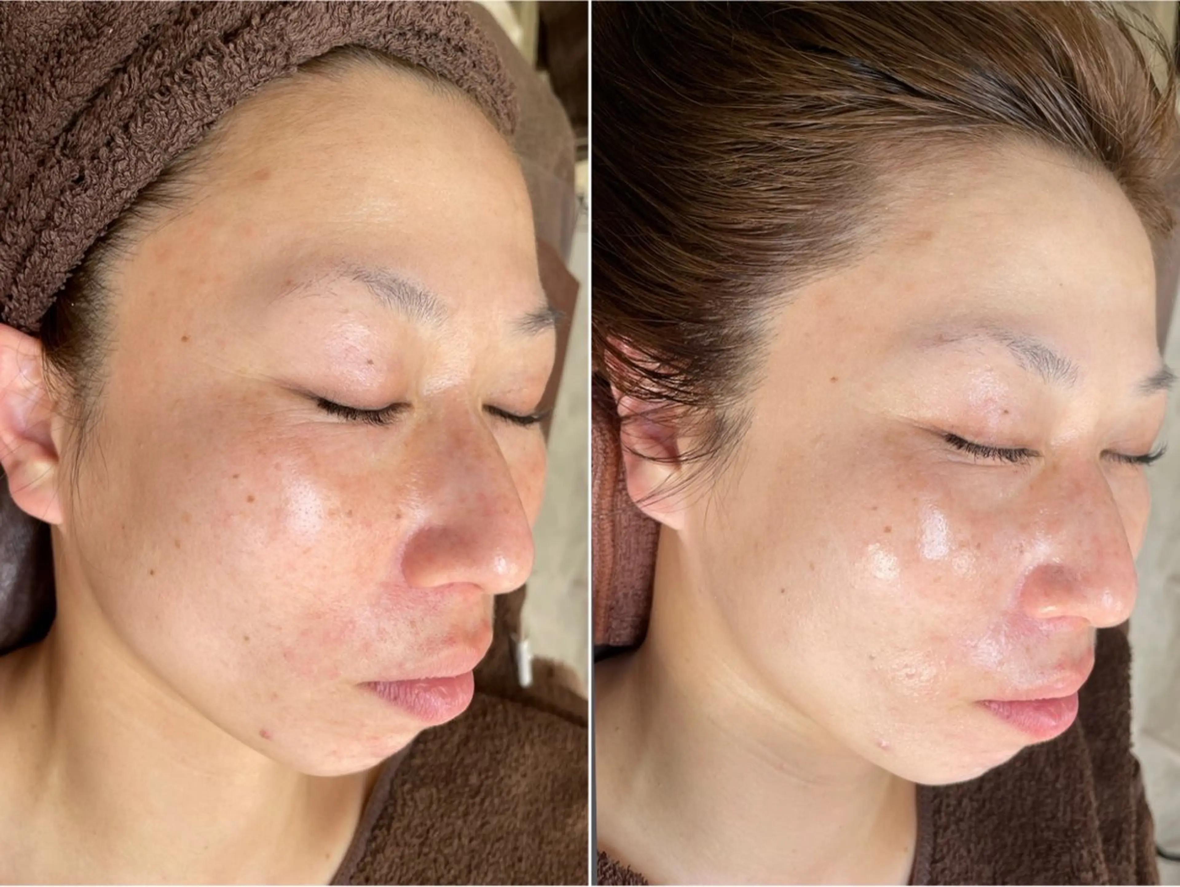 エステ 脱毛和みサロン新茶屋所属・脱毛和みサロン新茶屋 ひろみ（女性専用）のエステ・リラクイメージ