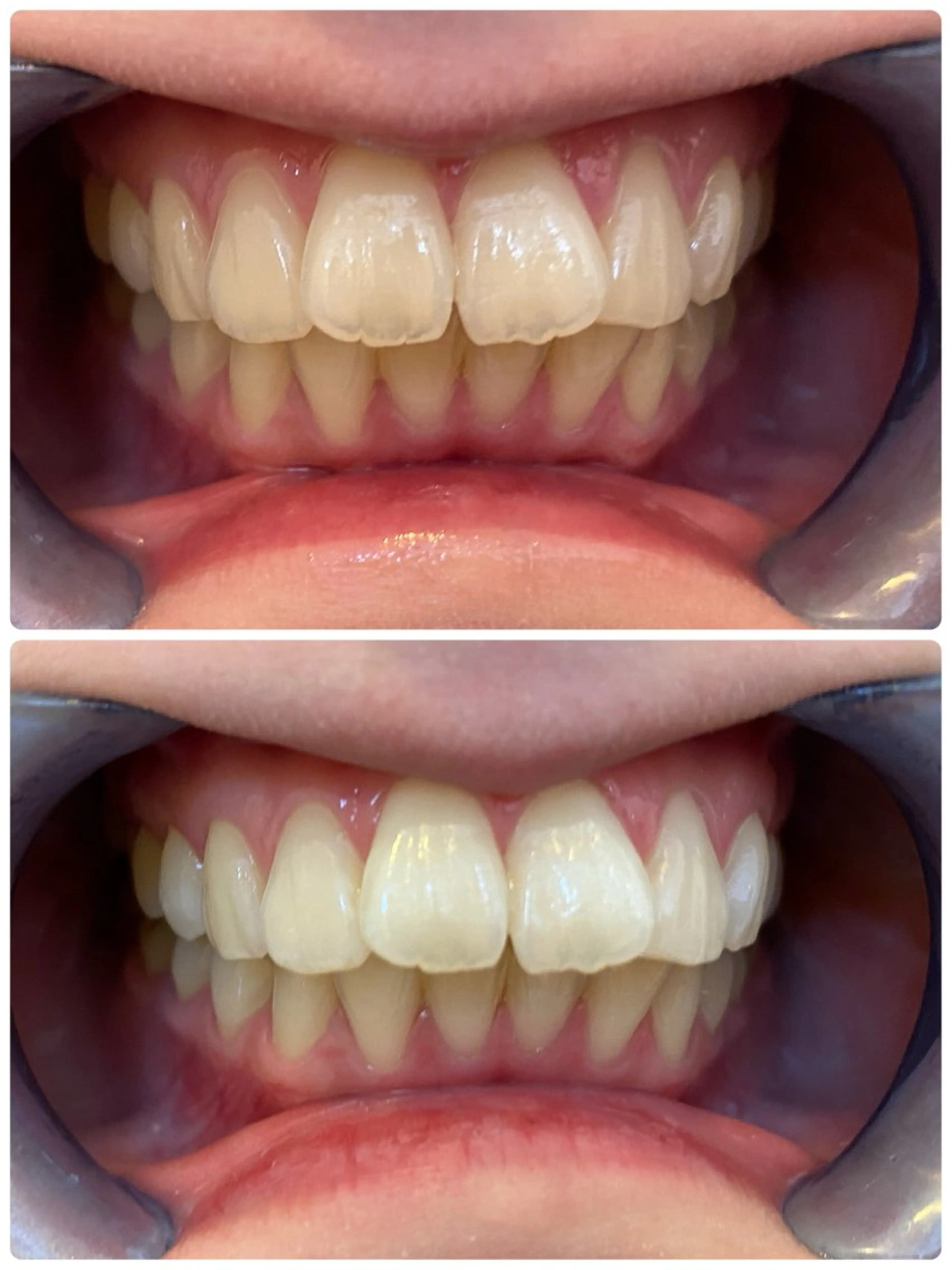 ダイヤモンドホワイトニング渋谷所属・DIAMOND BEAUYのその他イメージ