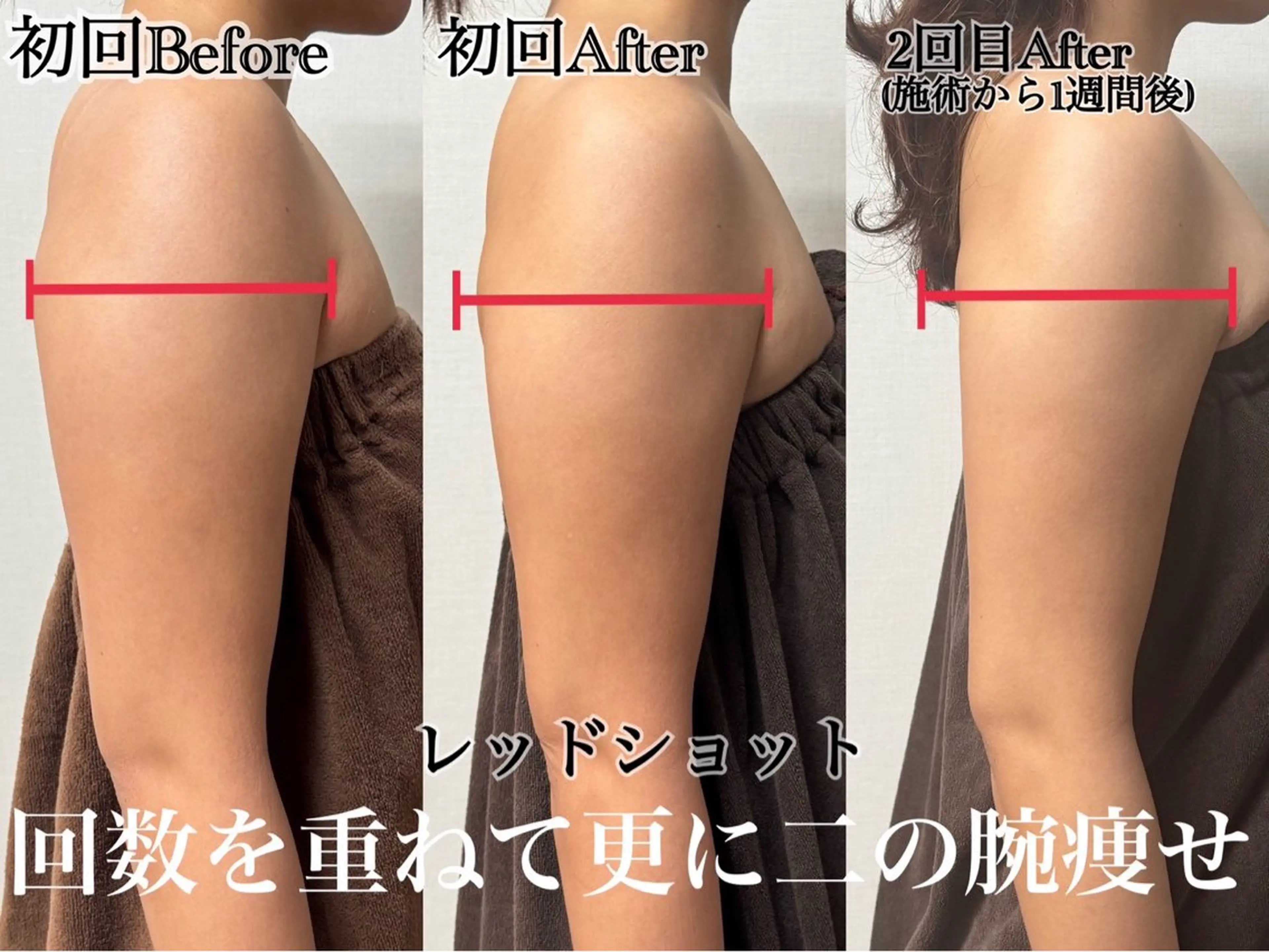 六本木脱毛andS さおりのエステ・リラクイメージ