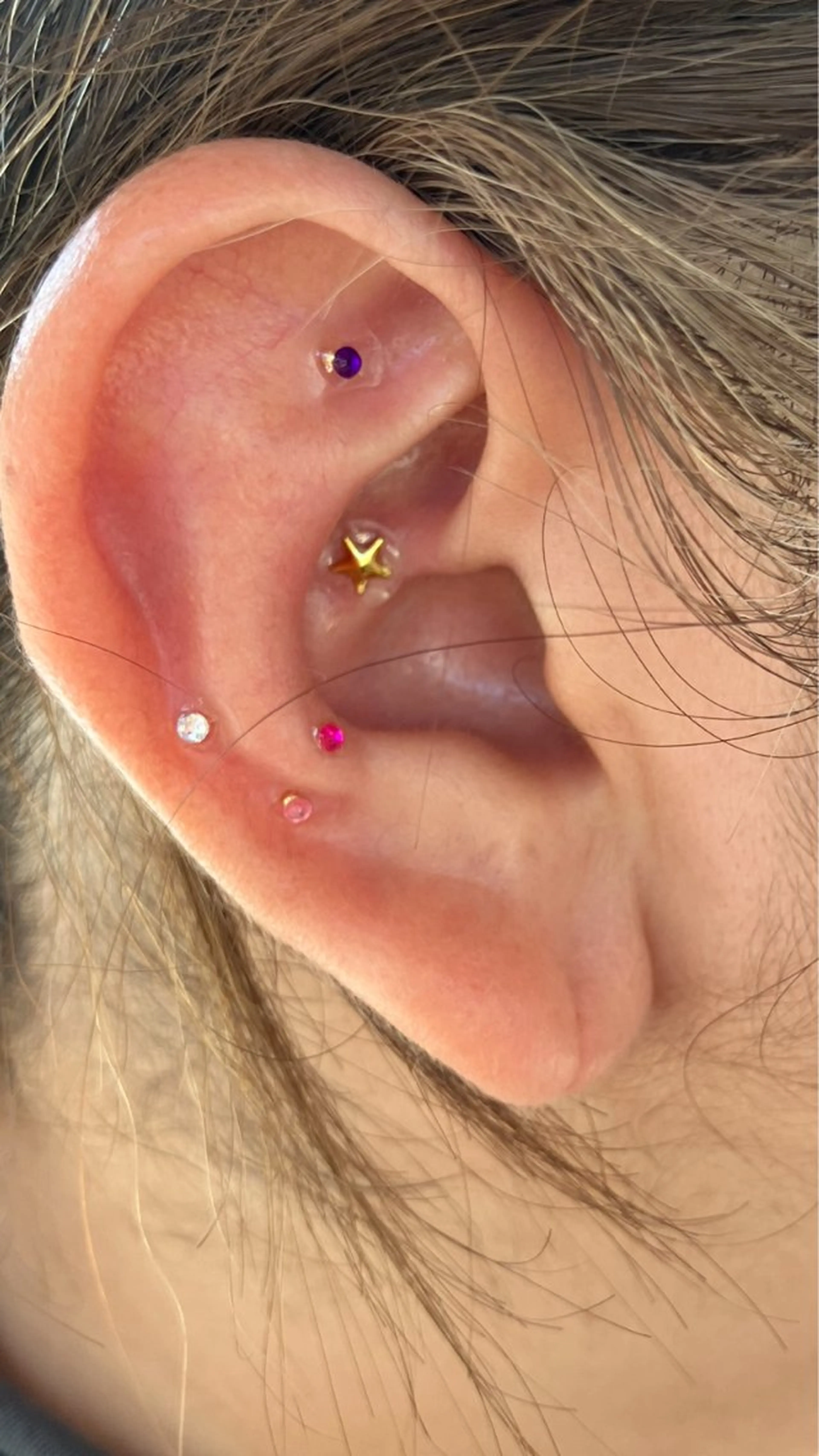 lymph lecielのその他イメージ