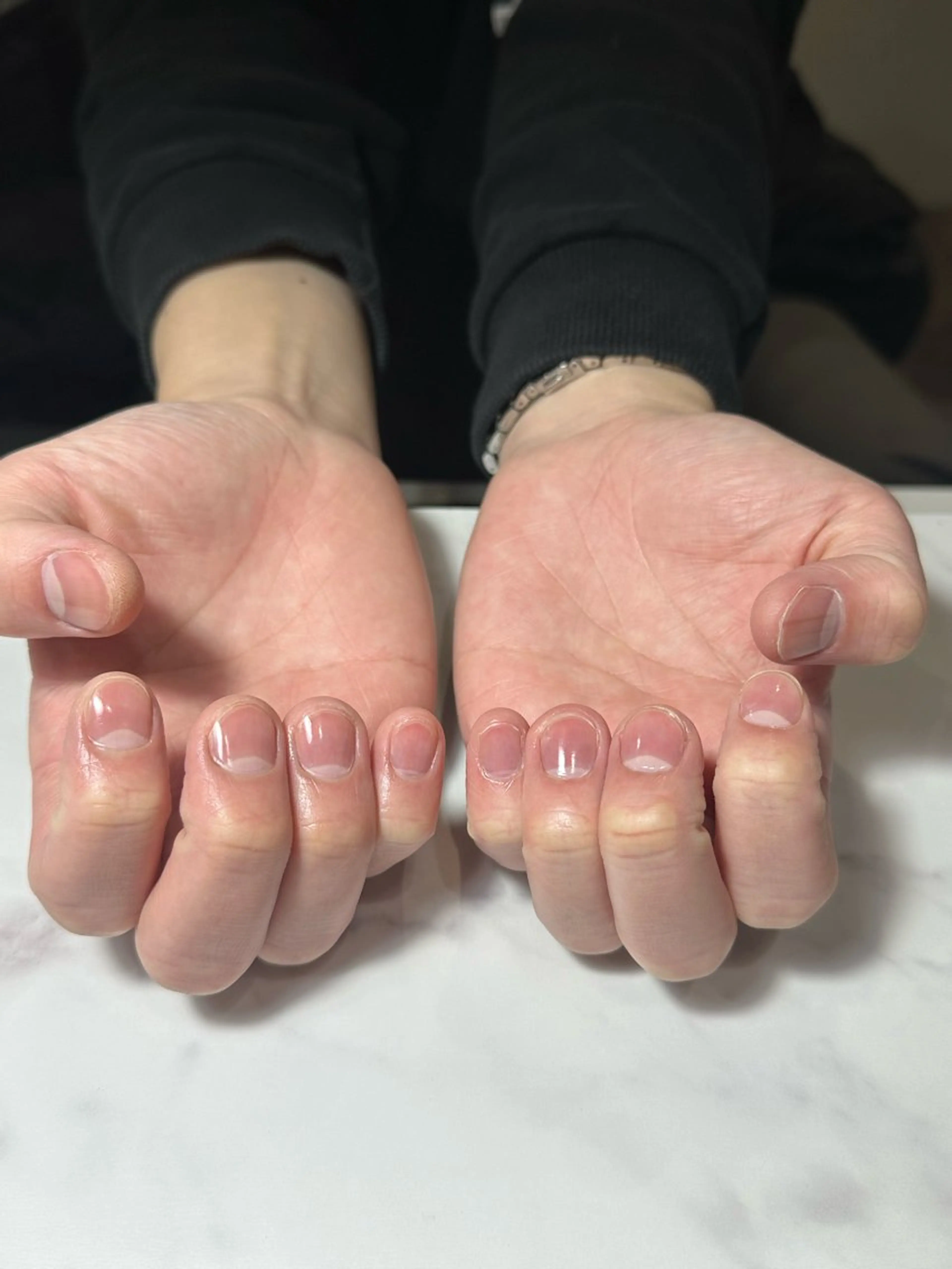 ハンドケア(ご新規様限定)の写真