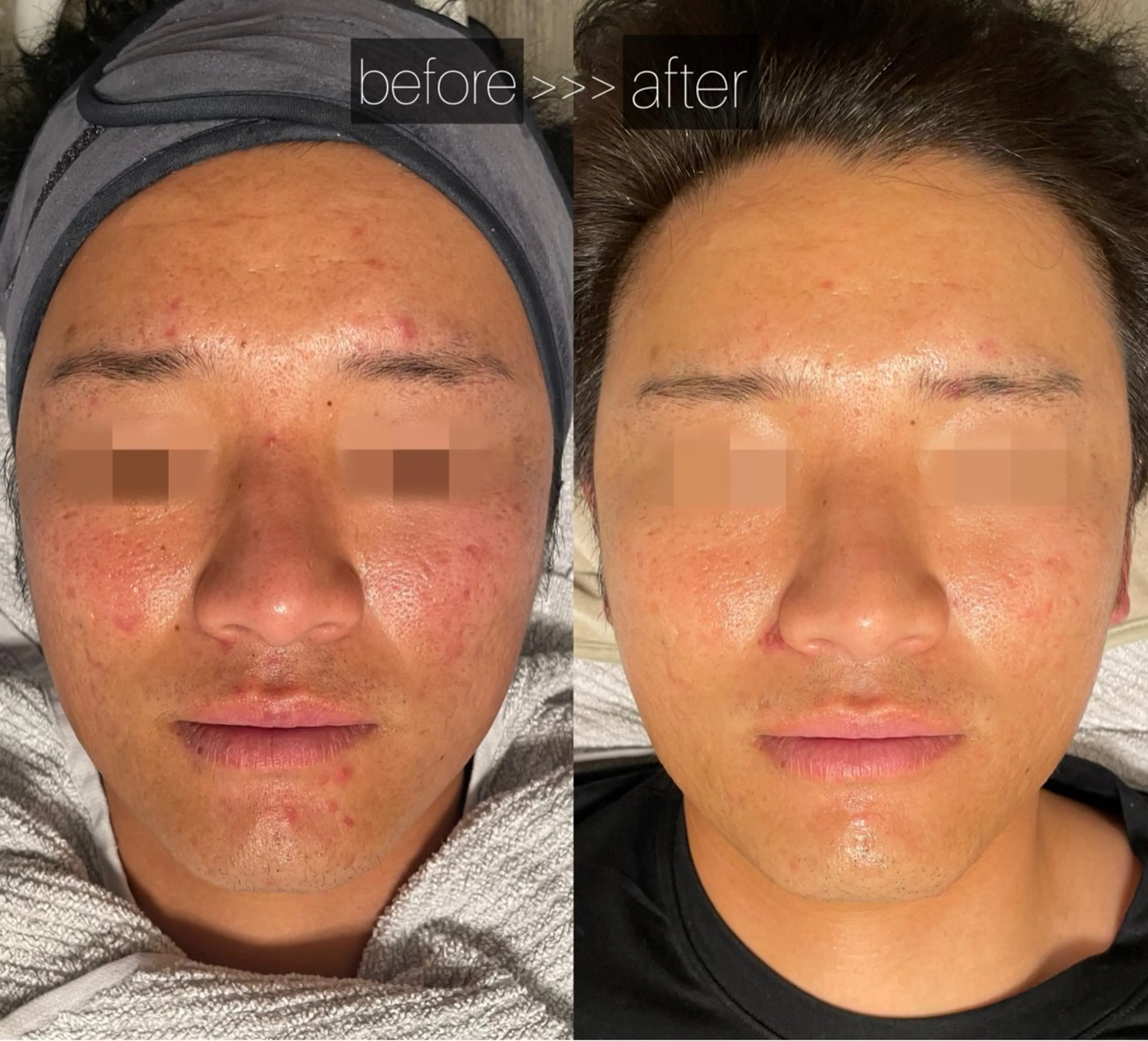 エステ 成宮鍼灸整骨院 & total  beauty  salon所属・中村 優美のエステ・リラクイメージ