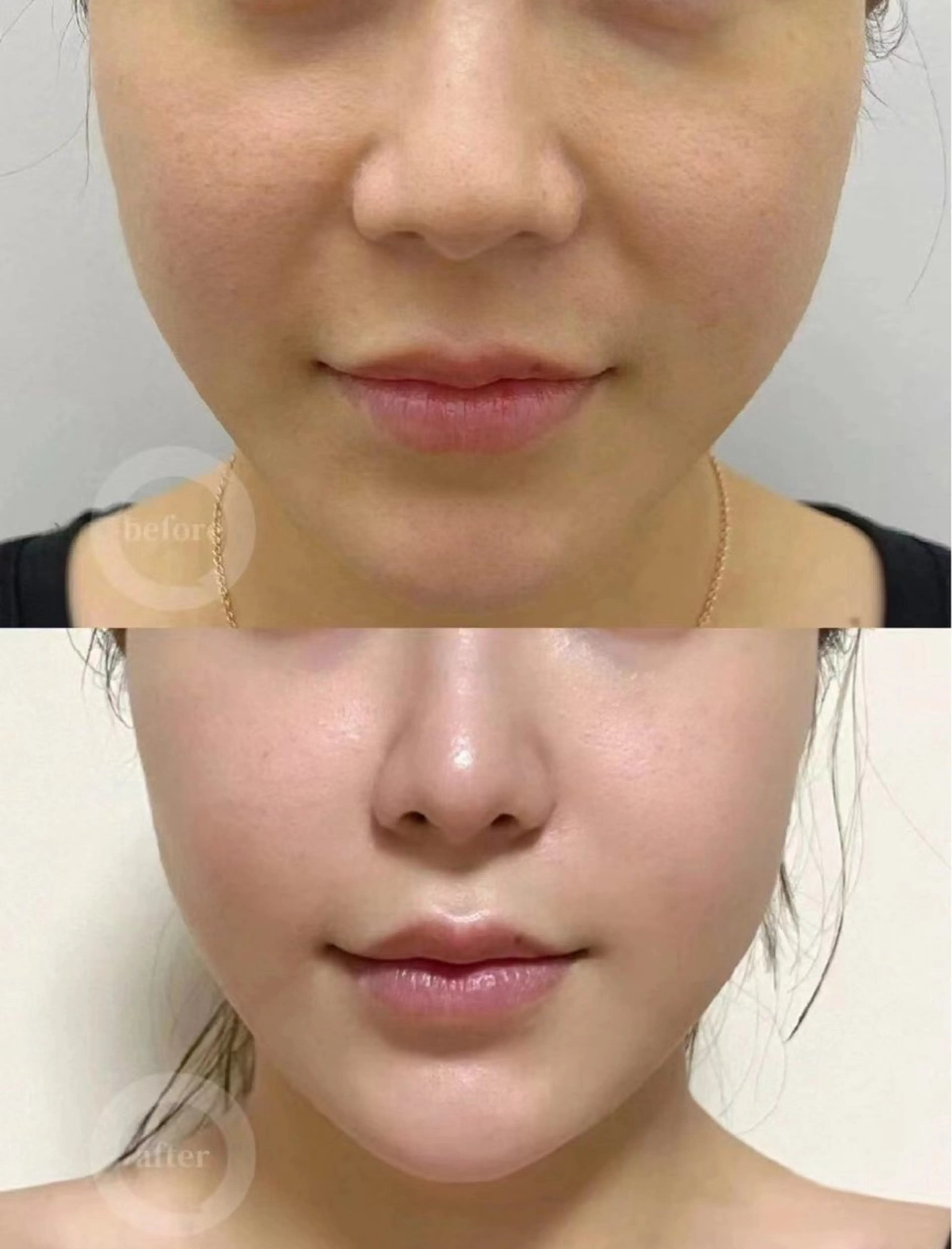 マツエク・マツパ 結婚式・ブライダル エステ aliaハイフ&水光ジェットサロン所属・aliaハーブ水光店 エステティシャン募集のエステ・リラクイメージ