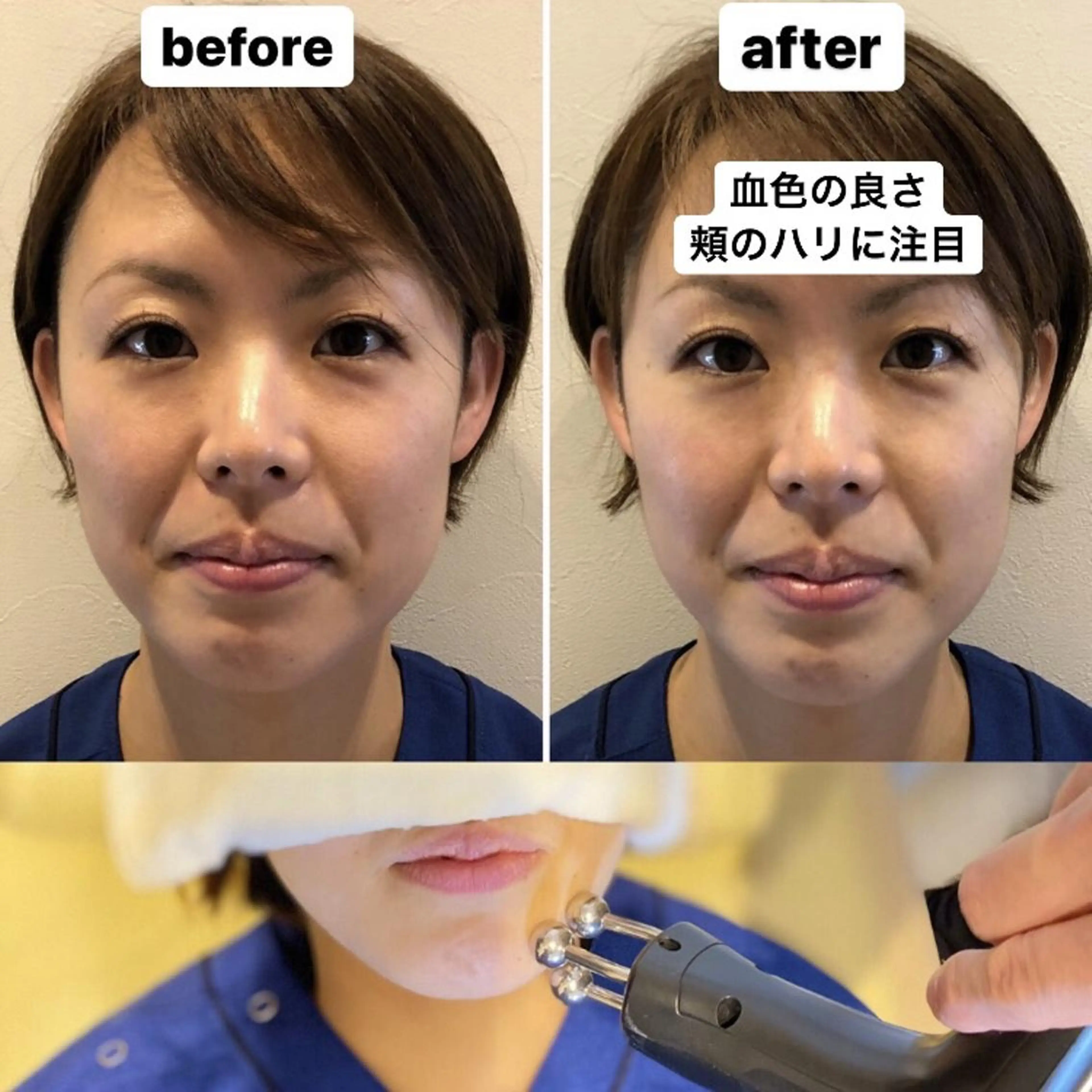 むくみたるみ専門☆ 美容鍼・小顔矯正のエステ・リラクイメージ