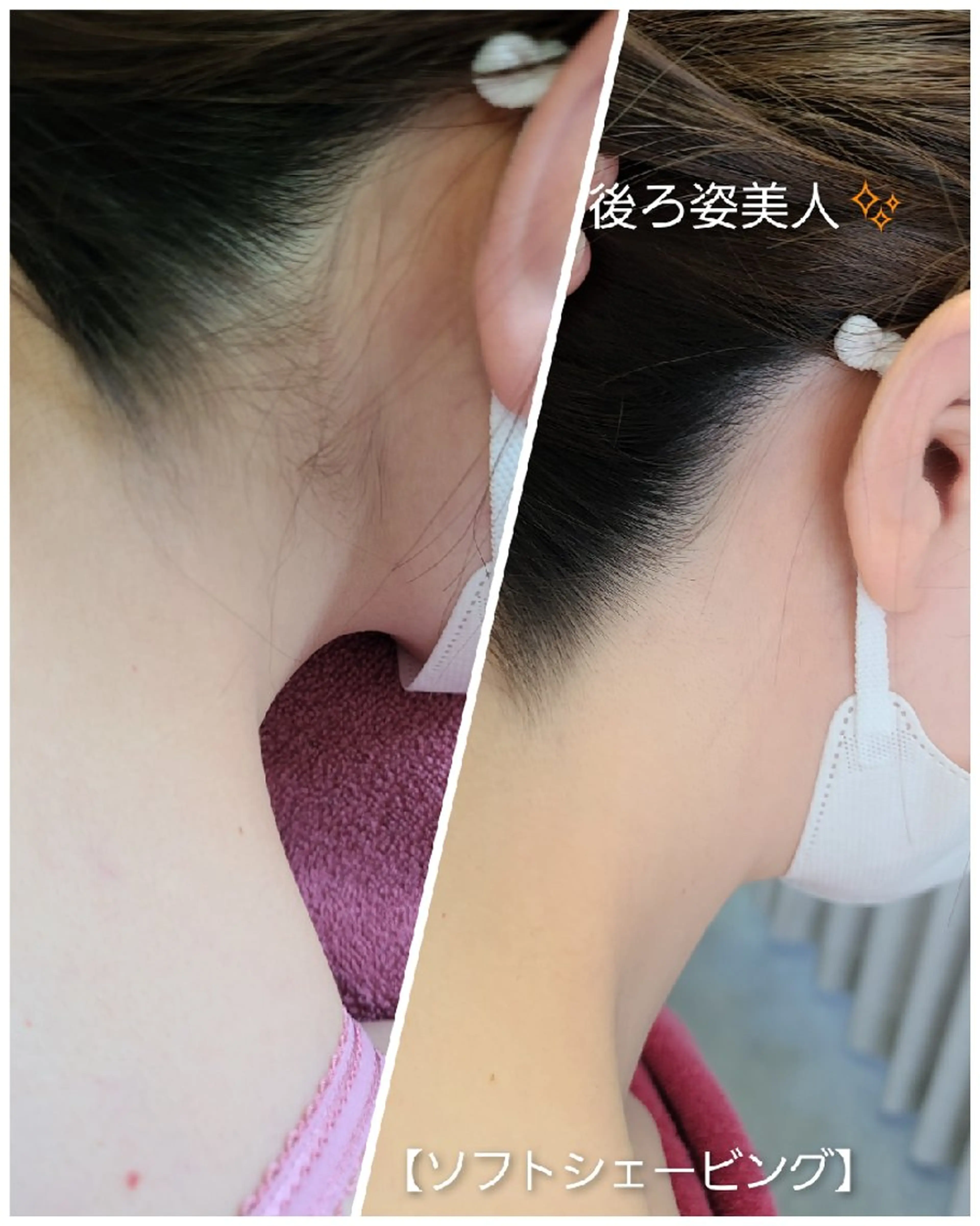 脱毛 パーソナルカラー・骨格/顔診断【eternity】所属・【トータル美容】 Eternityのその他イメージ