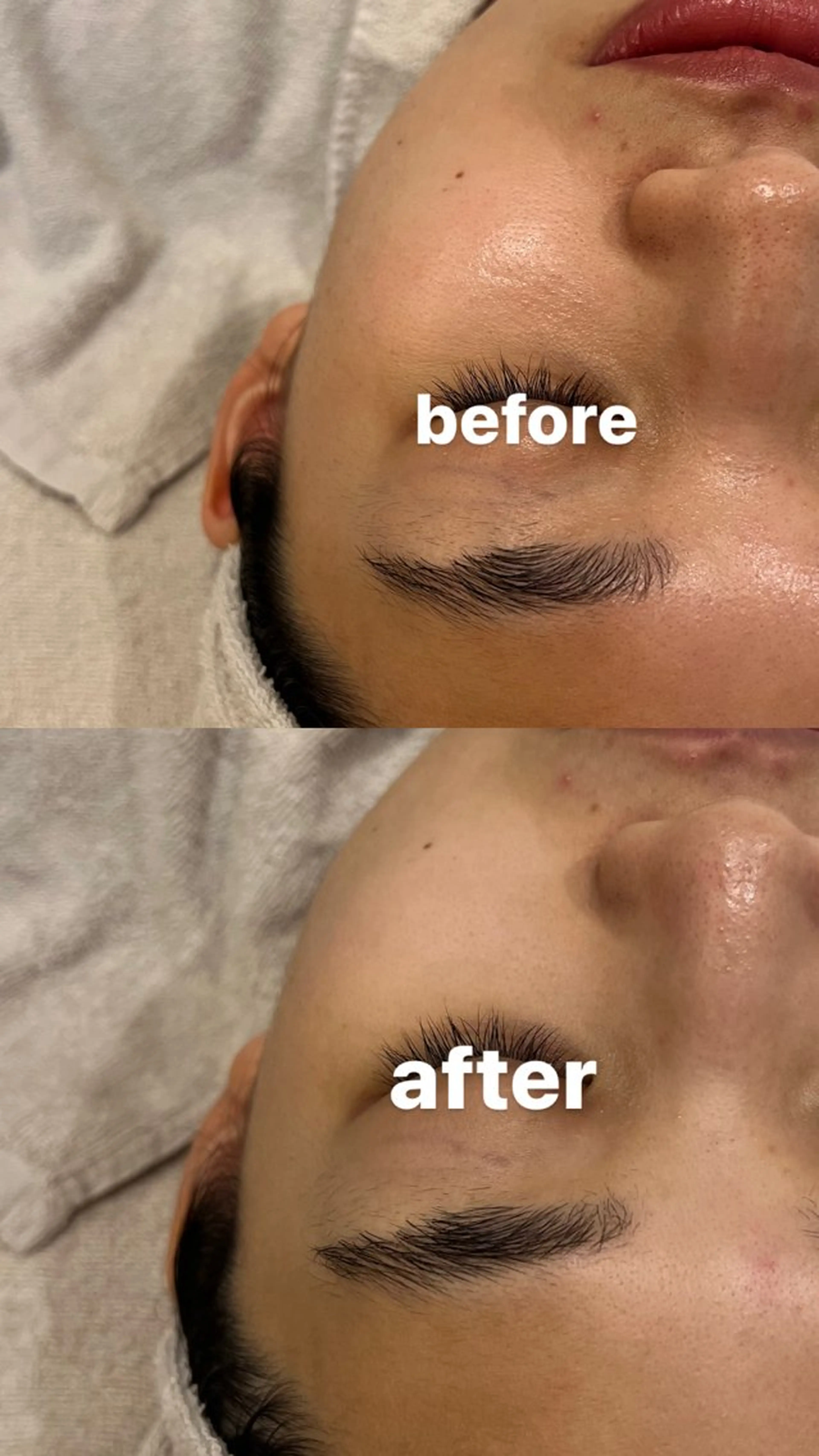 エステ リラク 【vidyto】ヴィディトゥ所属・肌管理サロン vidyto　MOEのエステ・リラクイメージ